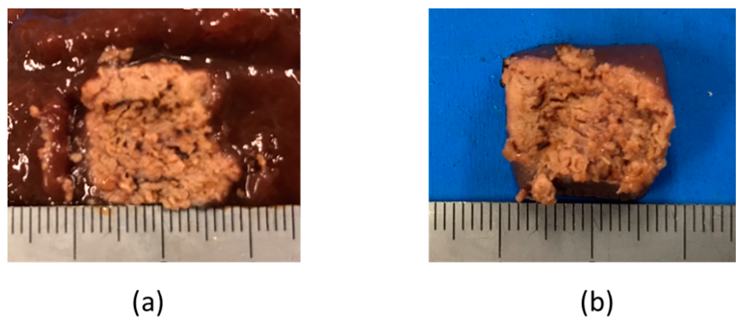 Diagnostics 08 00083 g012