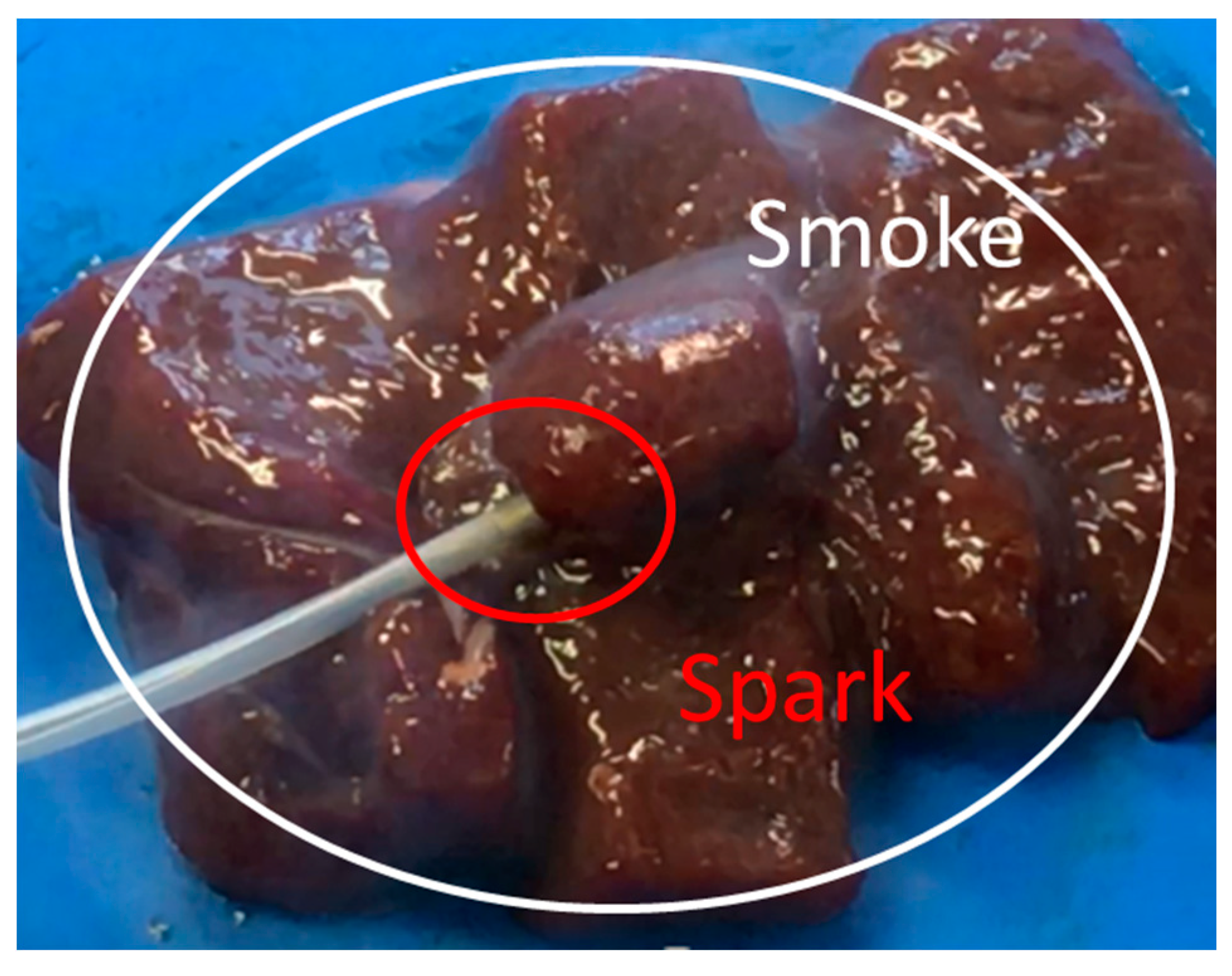 Diagnostics 08 00083 g013