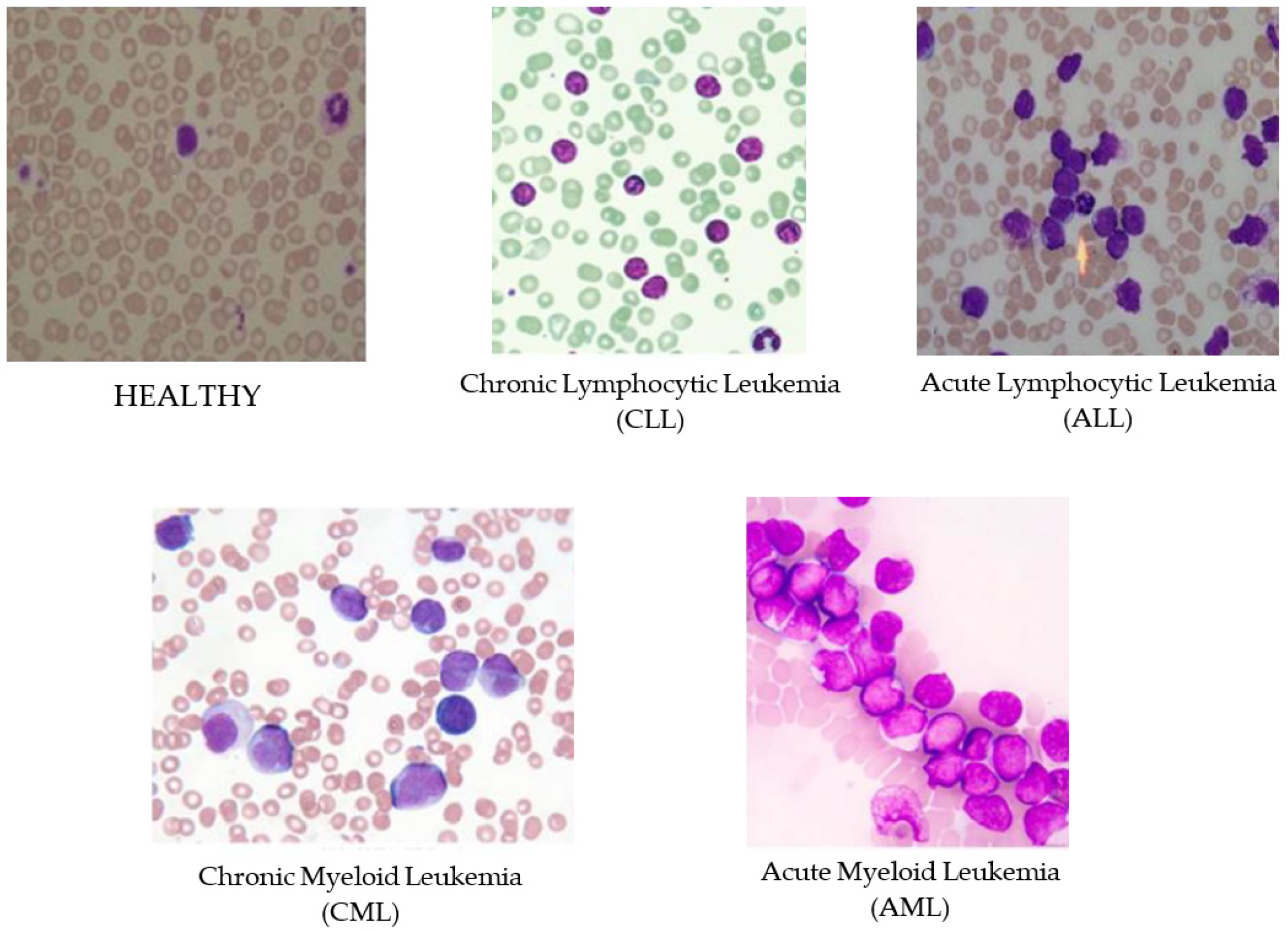 Diagnostics | Free Full-Text | Identification of Leukemia Subtypes from  Microscopic Images Using Convolutional Neural Network