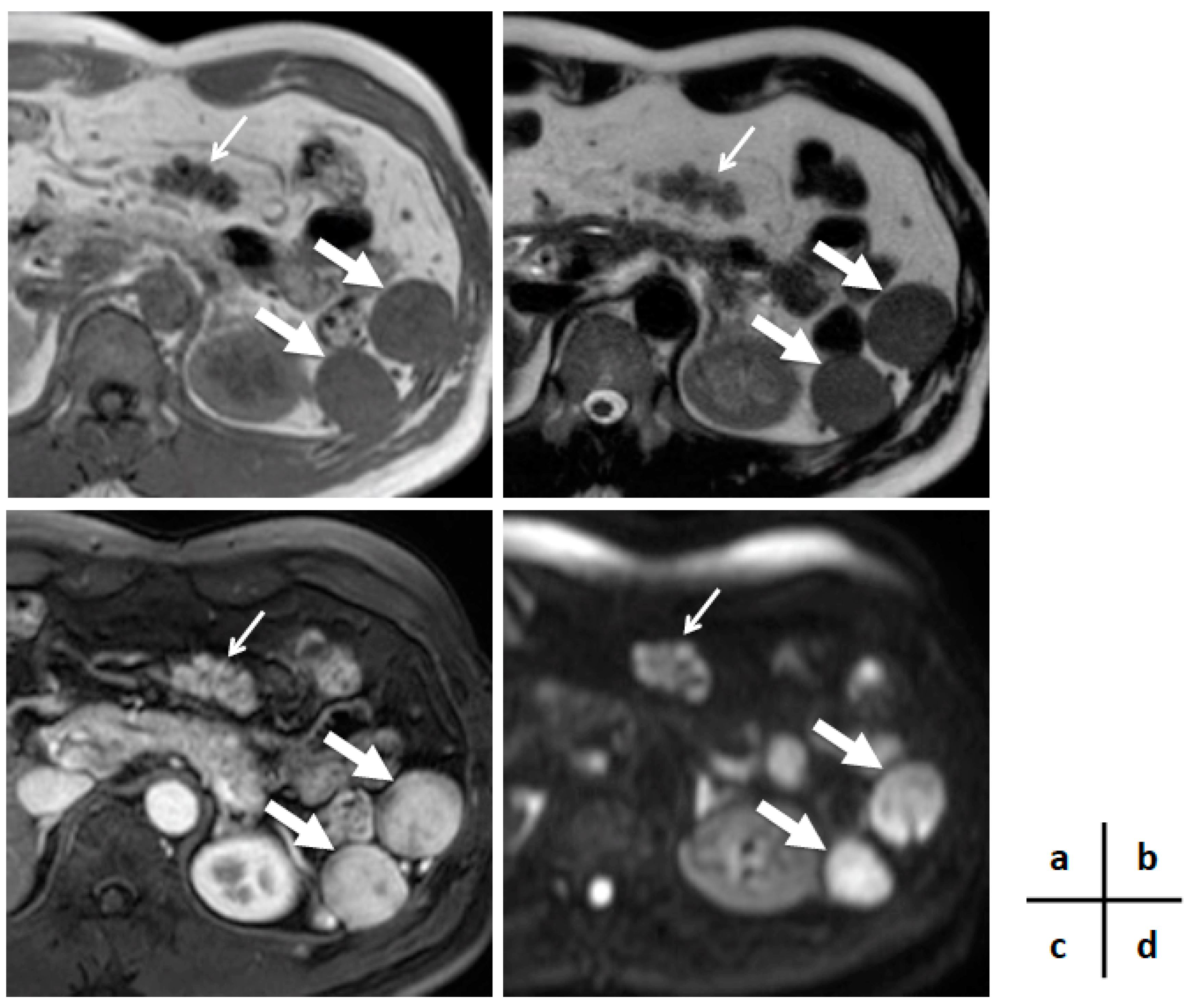 Diagnostics 09 00111 g002 Diagnostics 09 00111 g002