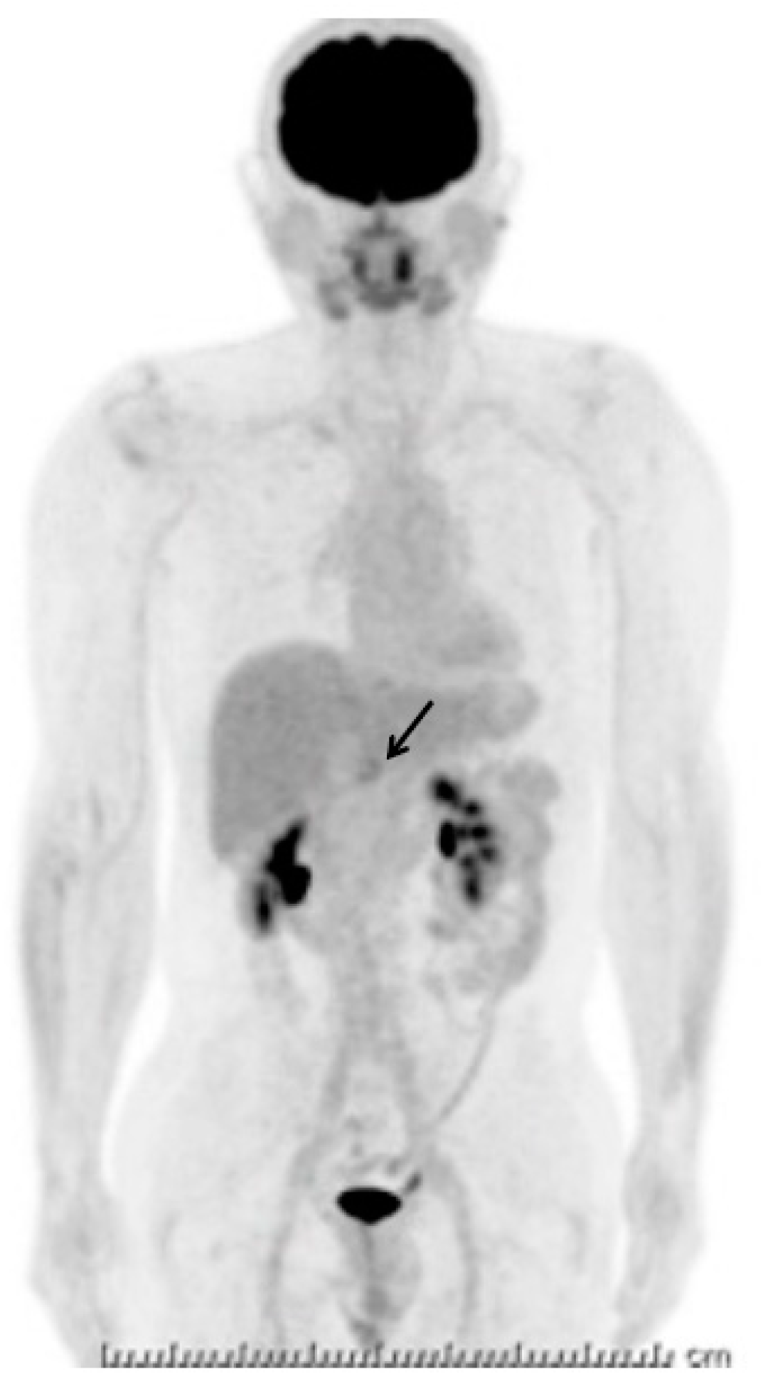 Diagnostics 09 00111 g003 Diagnostics 09 00111 g003