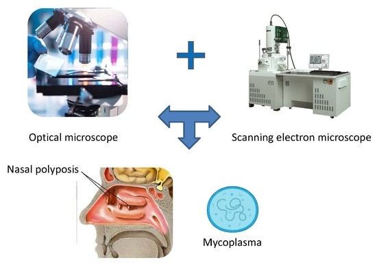 Diagnostics Free Full Text Identification And Characterization Of Nasal Polyposis And