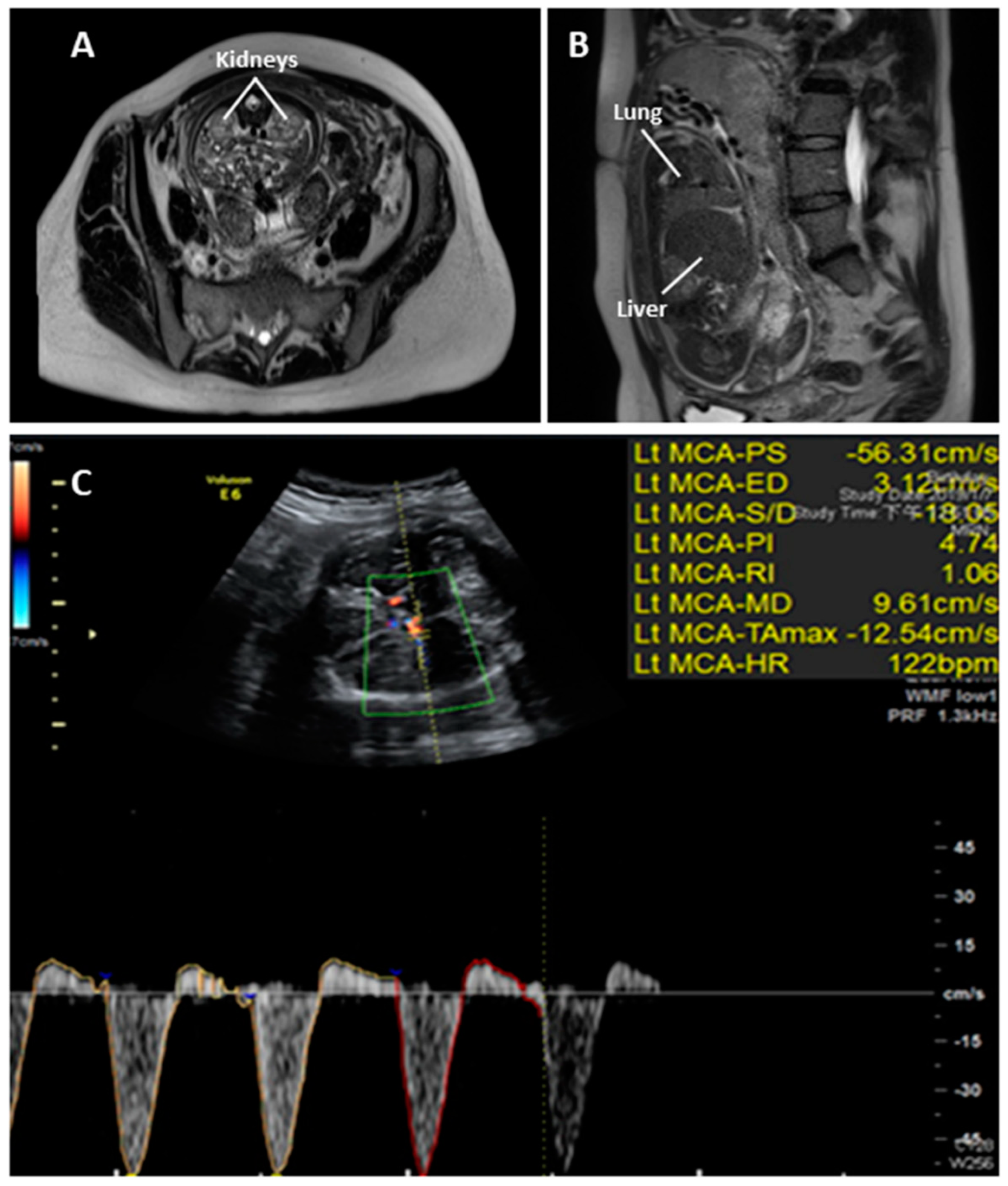 Diagnostics 09 00185 g003