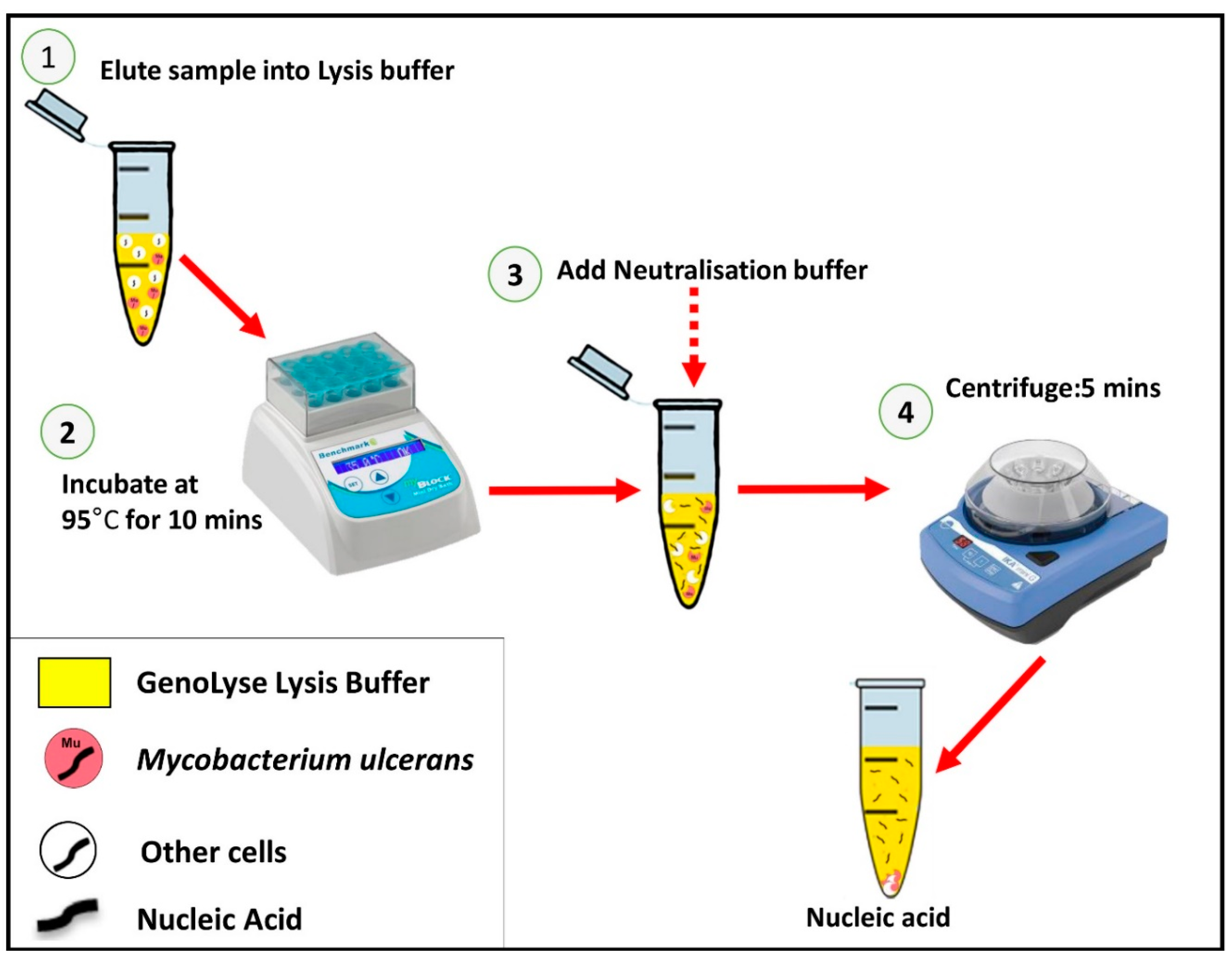 Diagnostics | Free Full-Text | Rapid Extraction Method of Mycobacterium  ulcerans DNA from Clinical Samples of Suspected Buruli Ulcer Patients