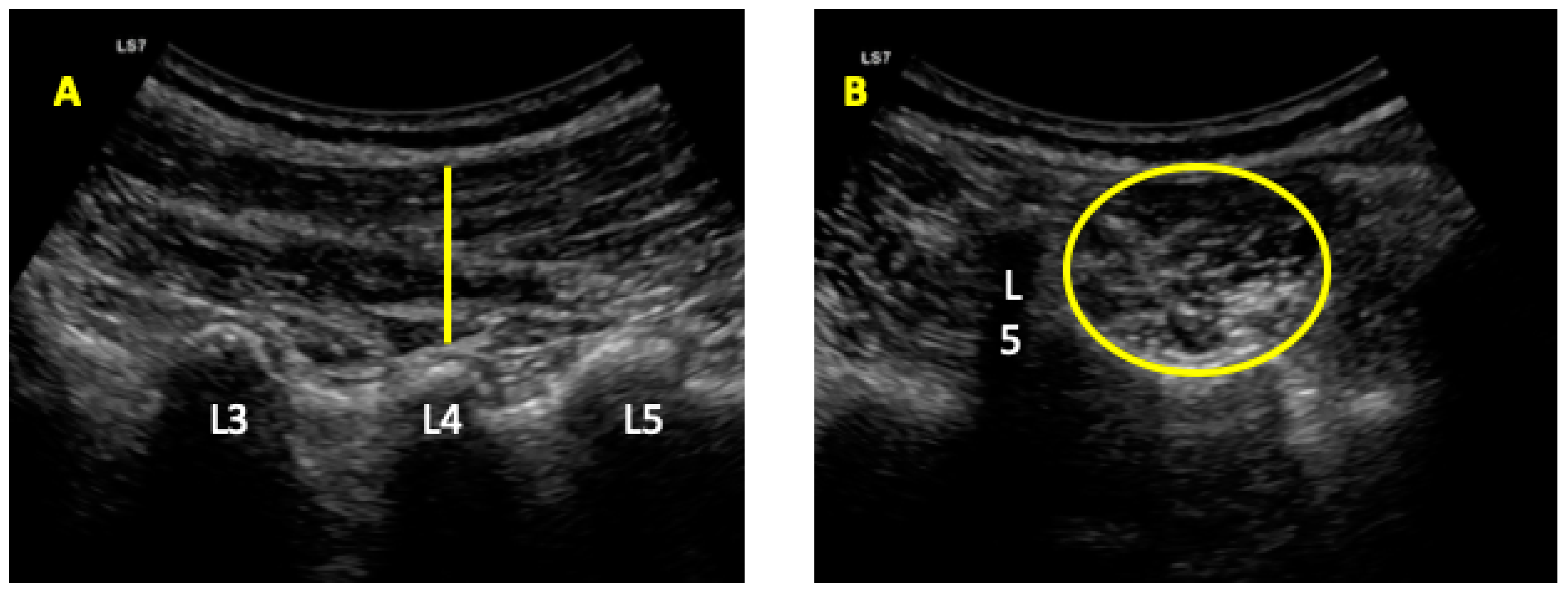 Diagnostics Free Full Text Ultrasound Imaging of the Abdominal