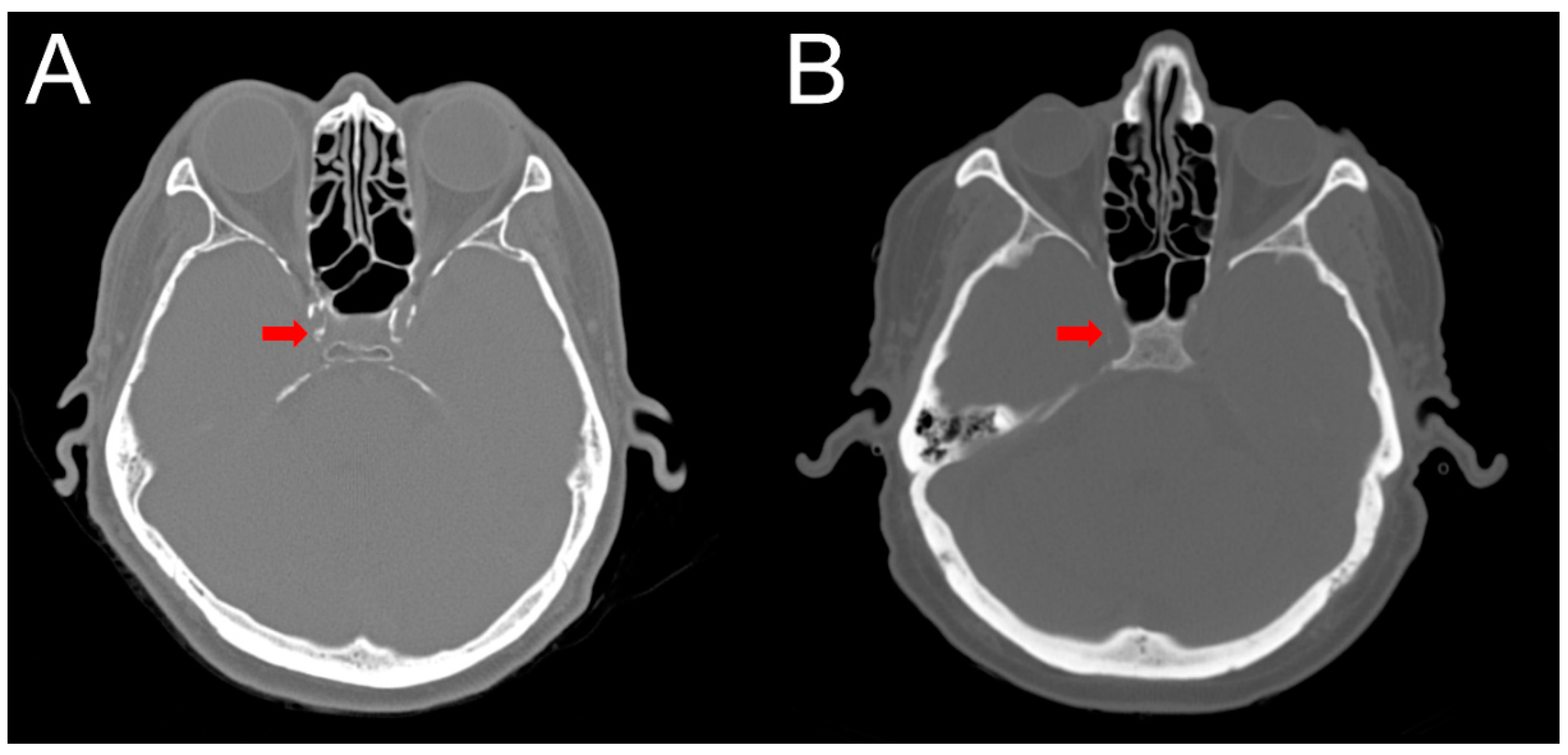 Diagnostics 10 00018 g002