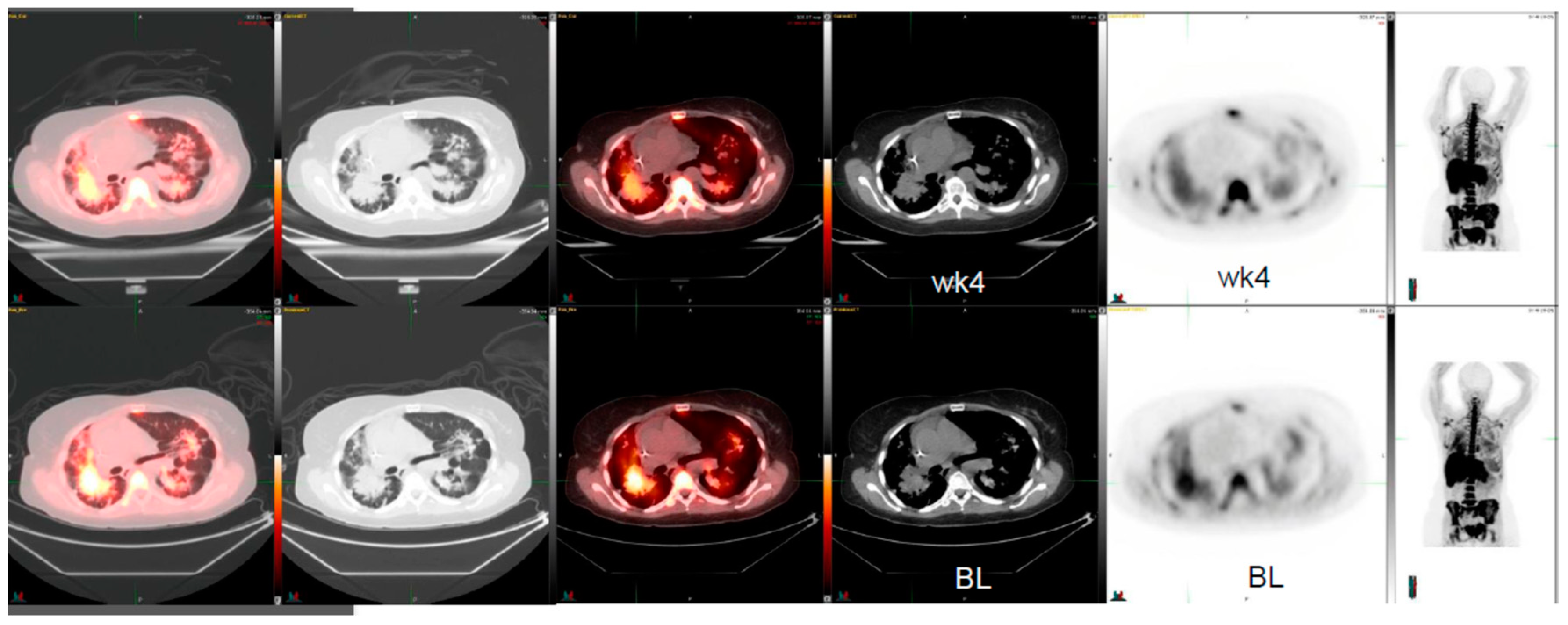 Diagnostics 10 00026 g002 Diagnostics 10 00026 g002