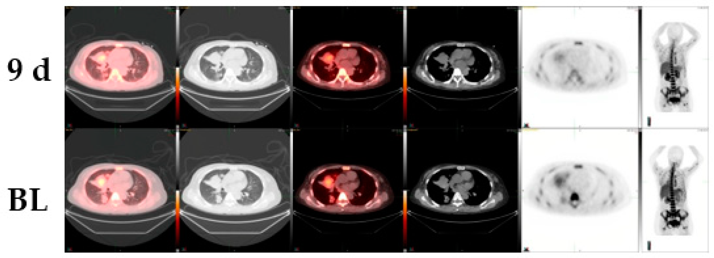 Diagnostics 10 00026 g003 Diagnostics 10 00026 g003
