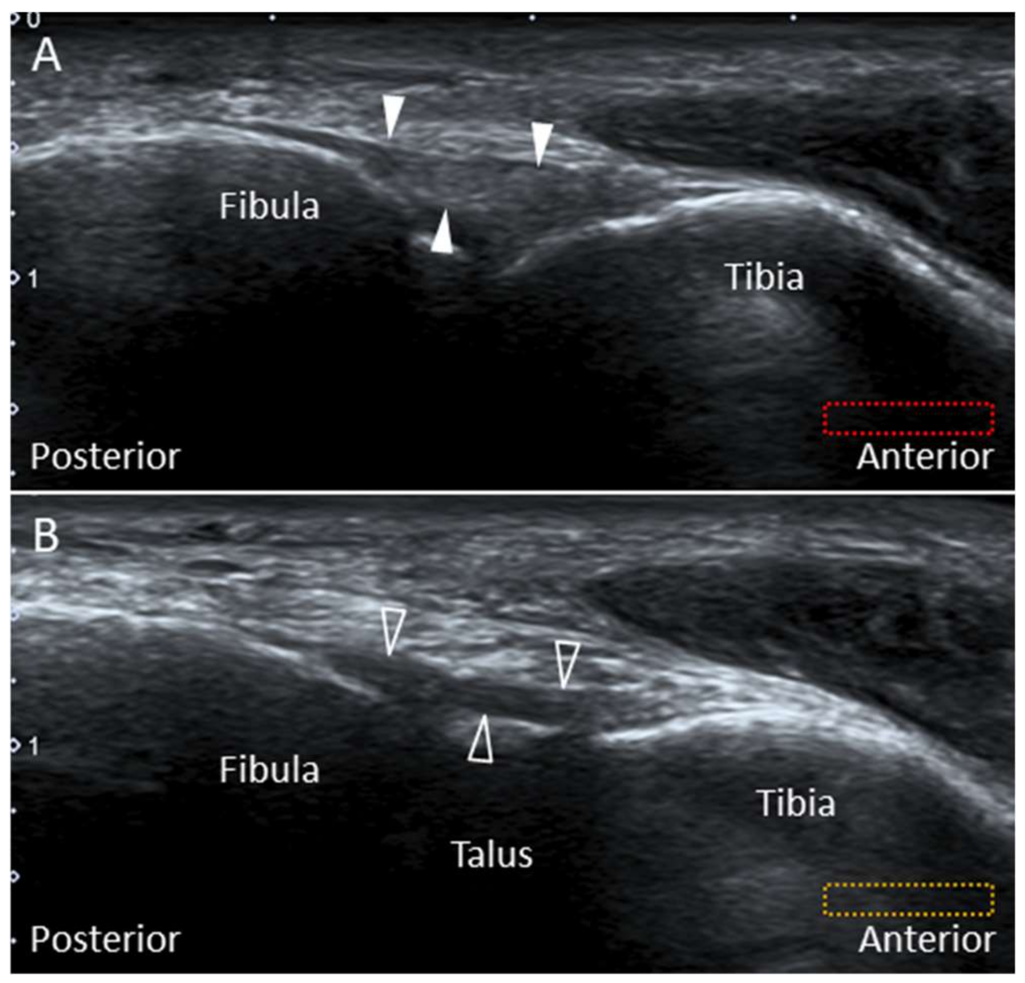 Diagnostics 10 00160 g004