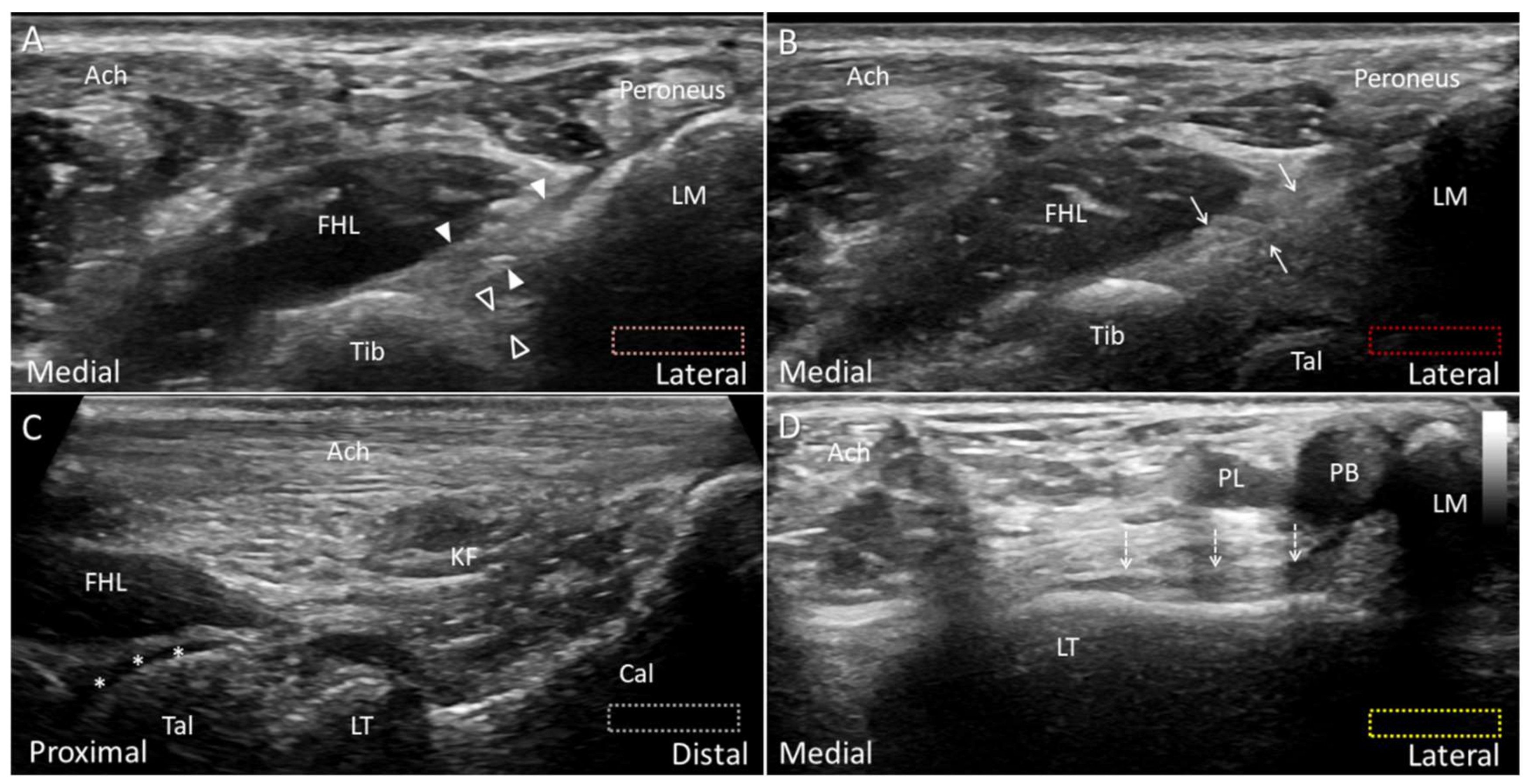 Diagnostics 10 00160 g005