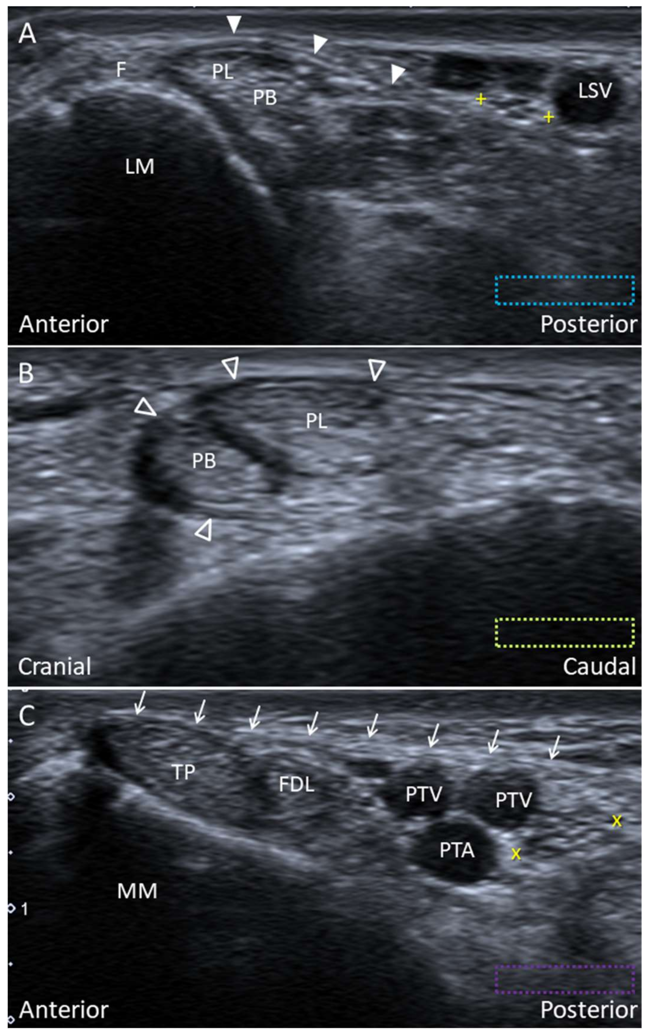 Diagnostics 10 00160 g018