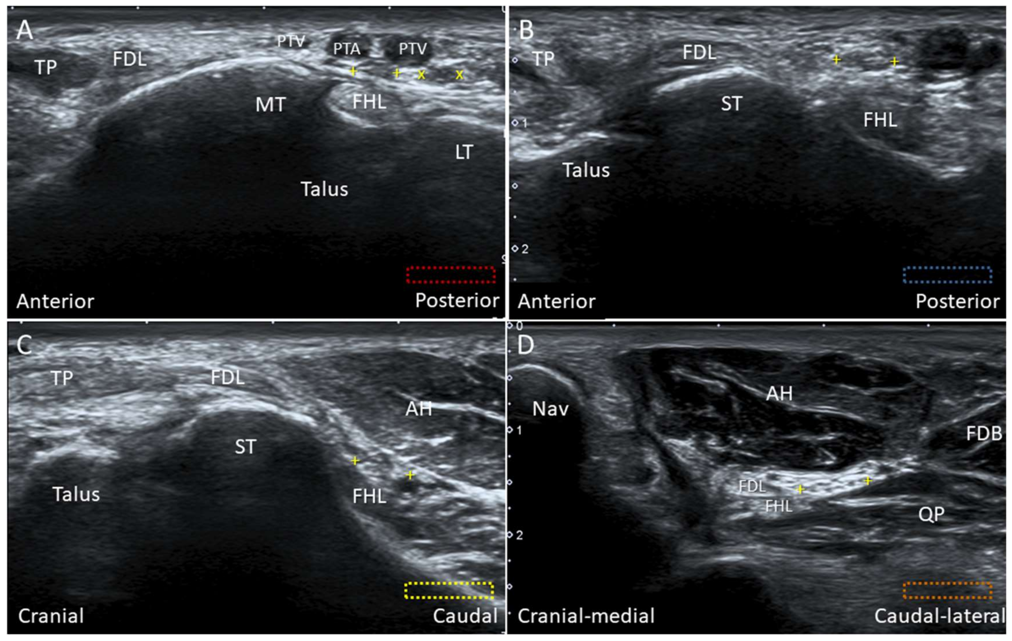Diagnostics 10 00160 g025