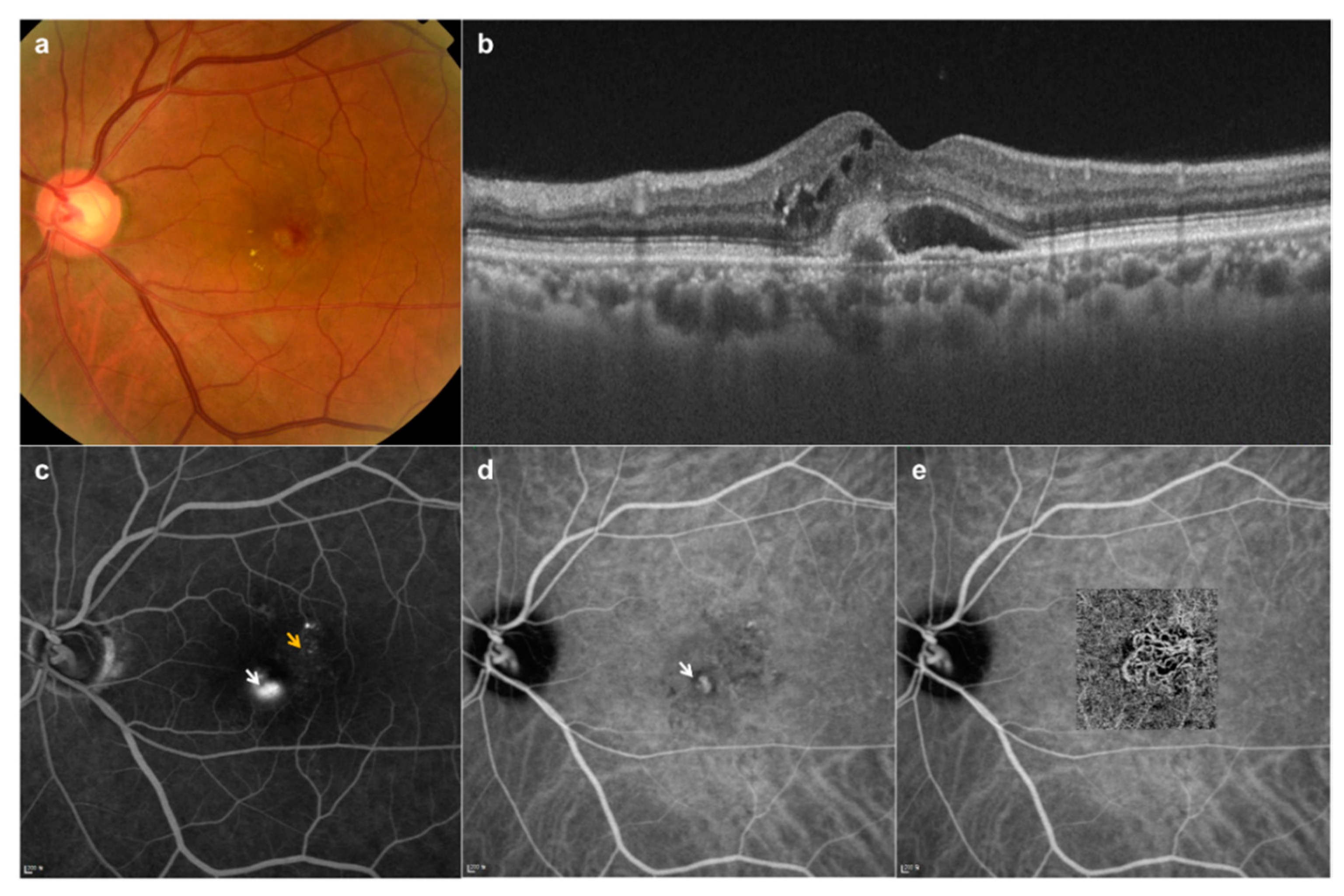 Diagnostics 10 00261 g002