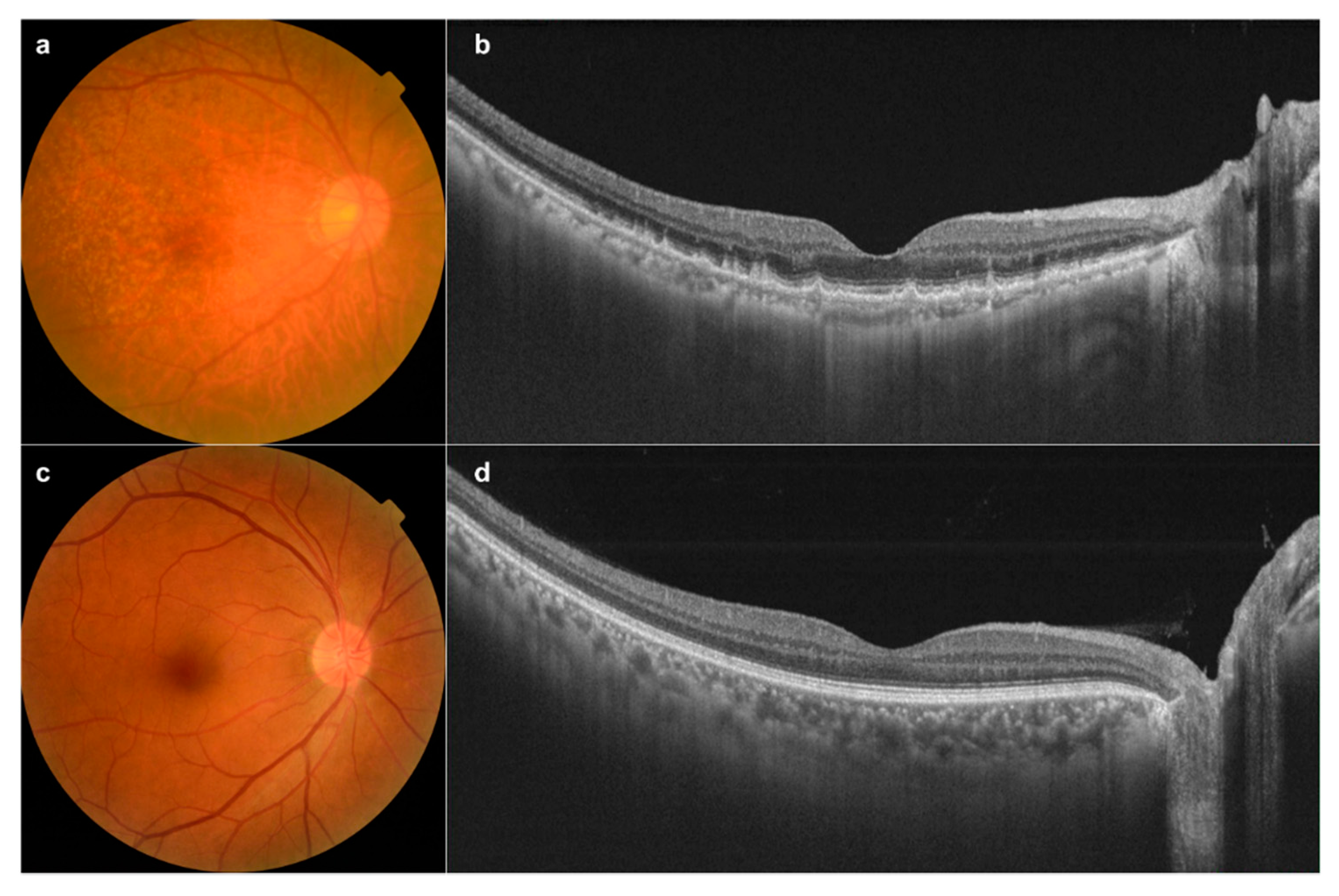 Diagnostics 10 00261 g003