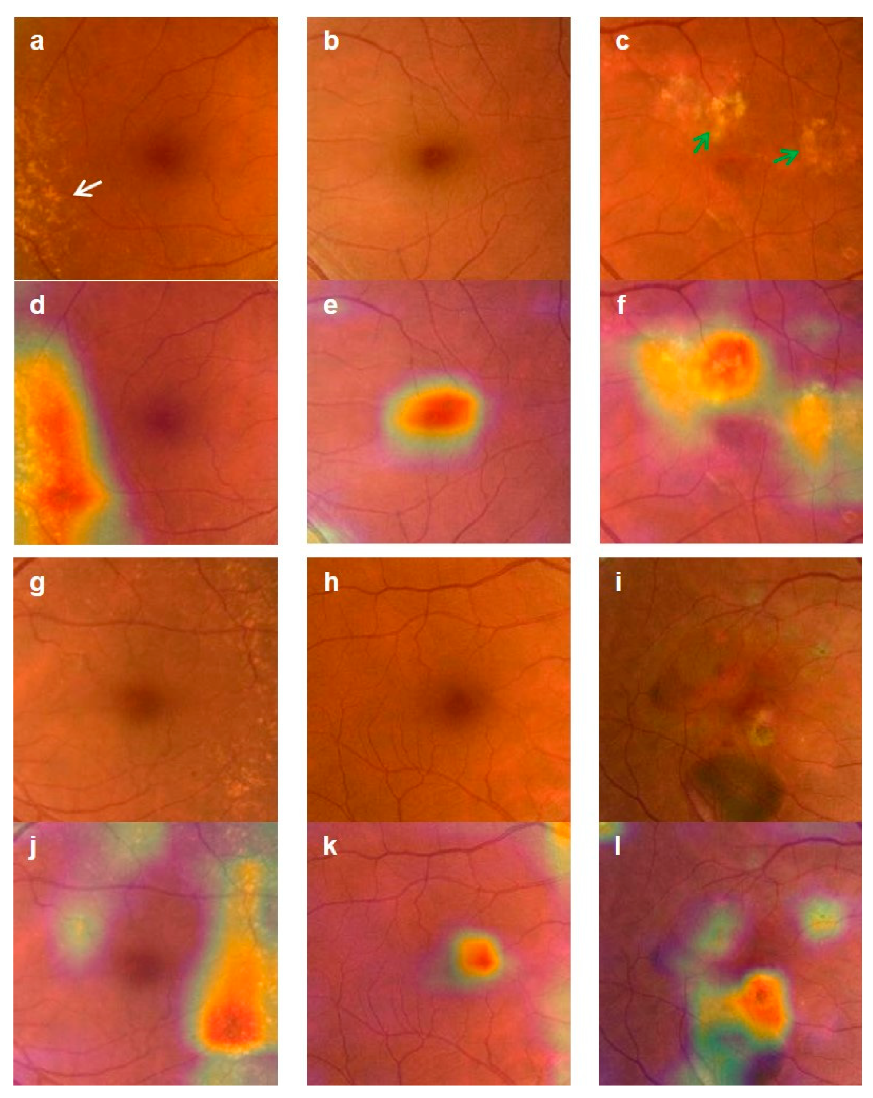 Diagnostics 10 00261 g005
