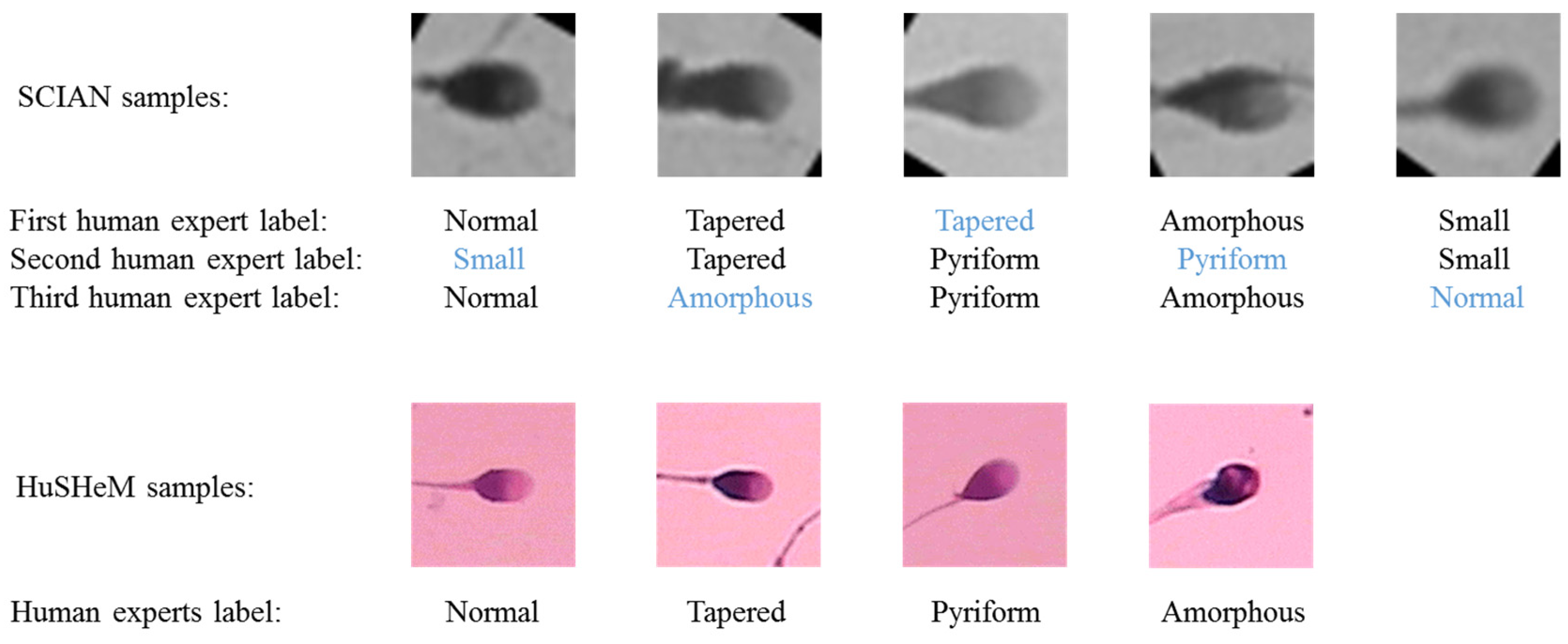 Sperm Morphology Classification