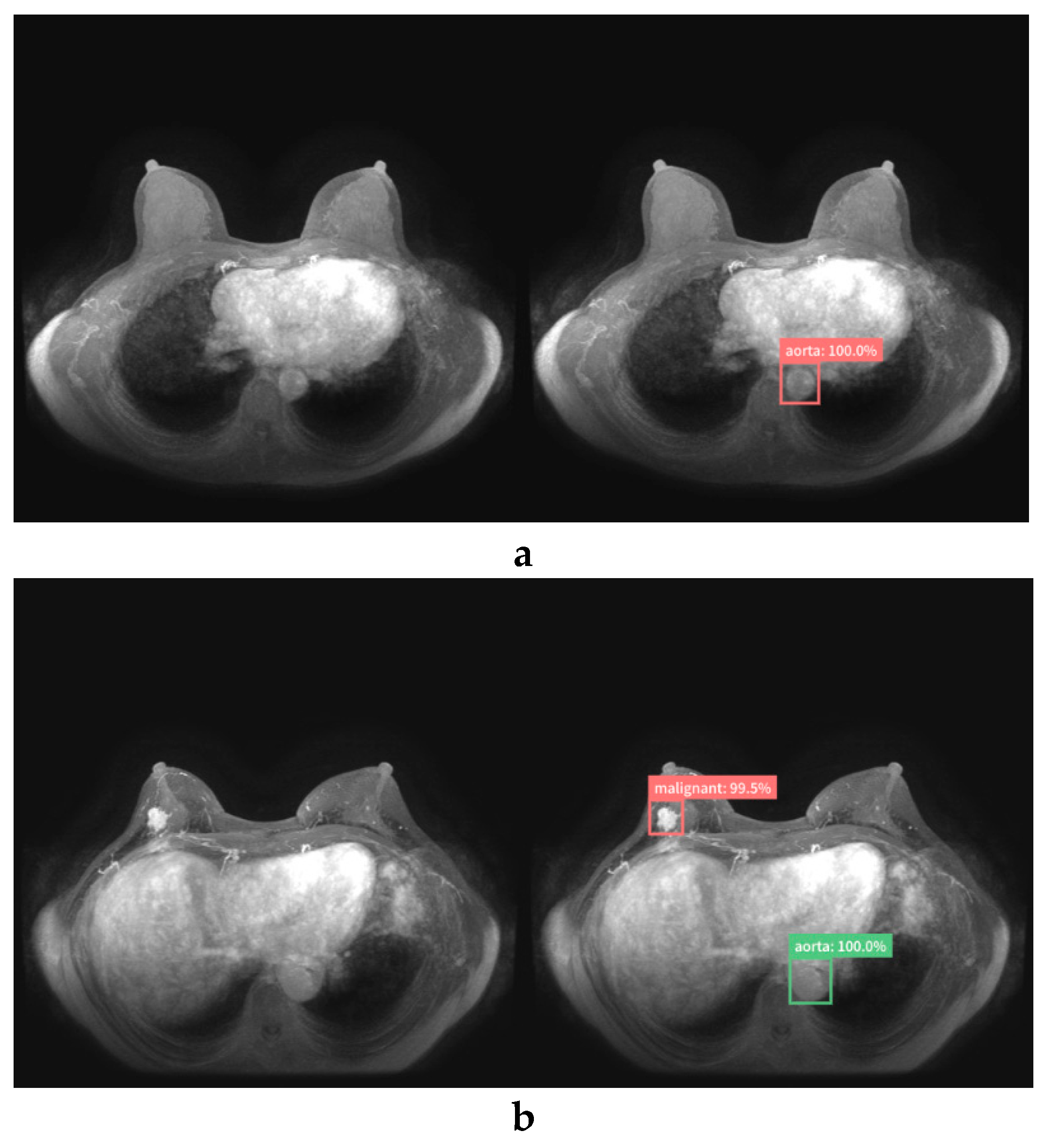Diagnostics 10 00330 g005a Diagnostics 10 00330 g005a