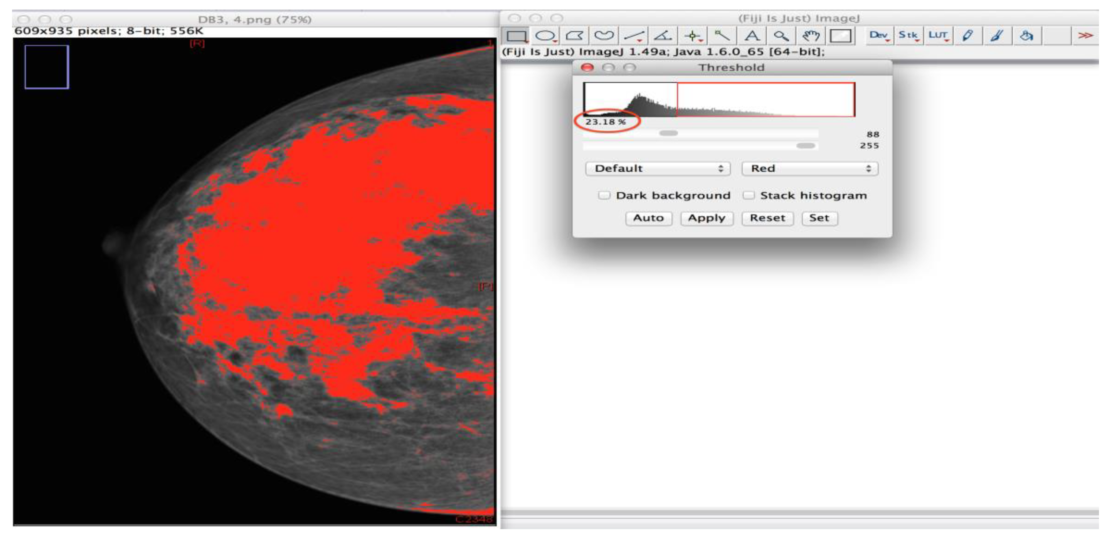 Diagnostics 10 00331 g002