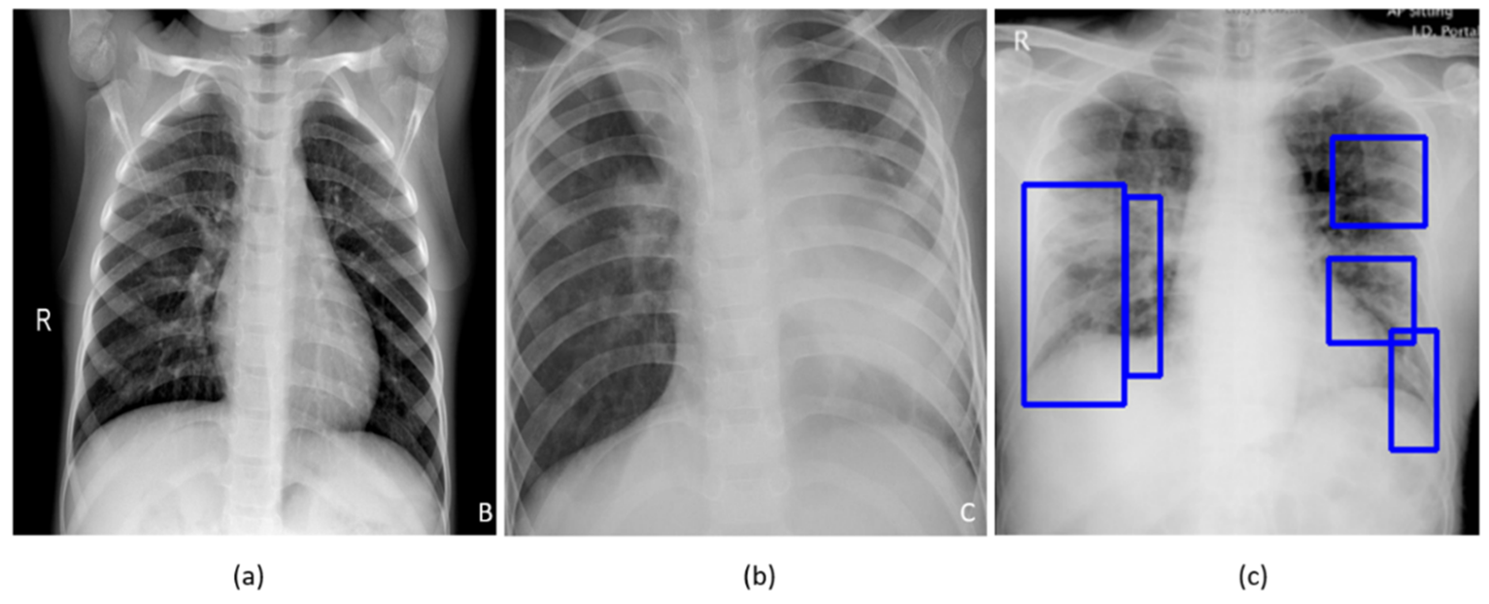 Diagnostics | Free Full-Text | Weakly Labeled Data Augmentation for Deep  Learning: A Study on COVID-19 Detection in Chest X-Rays | HTML