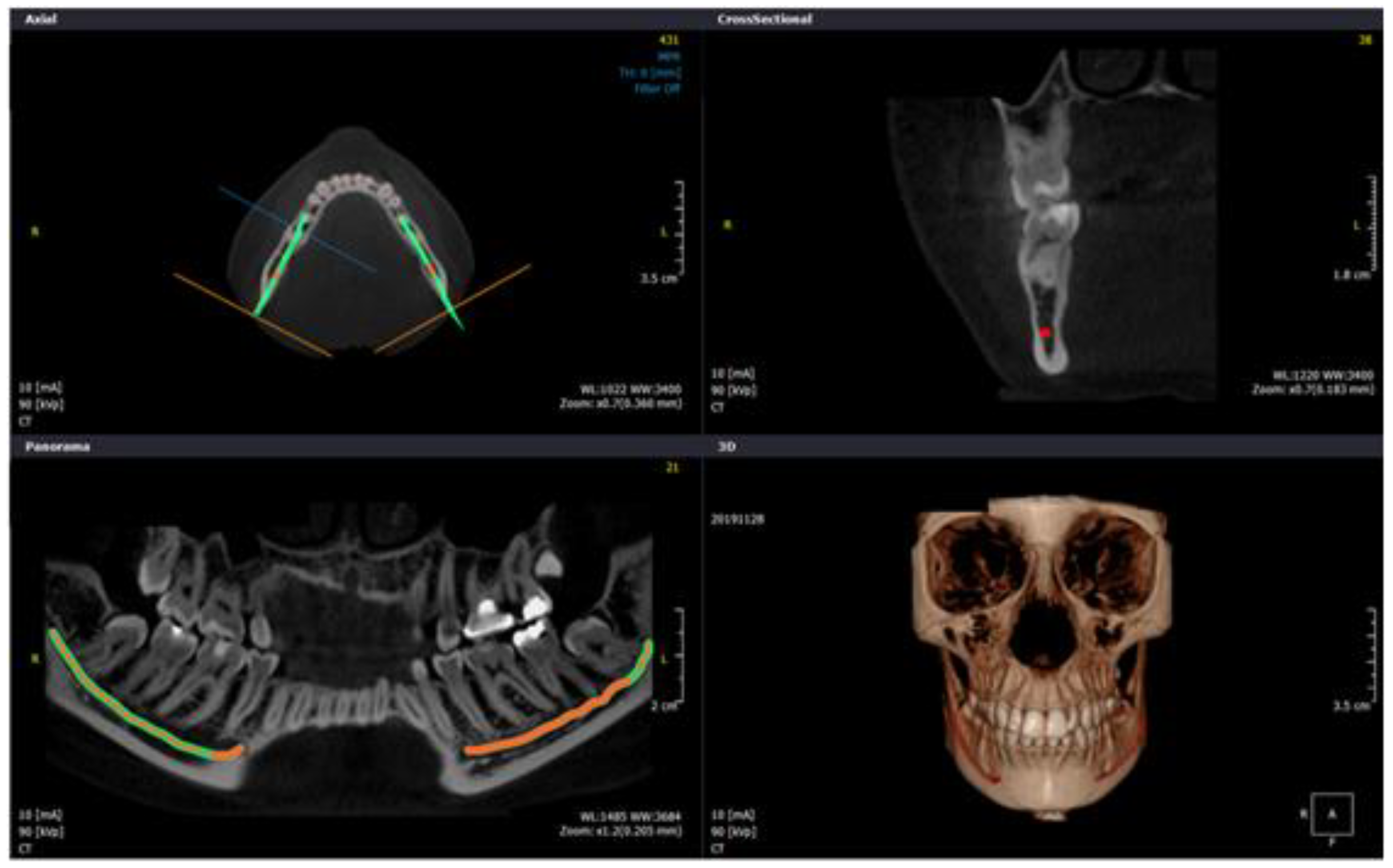 Diagnostics 10 00406 g005 Diagnostics 10 00406 g005