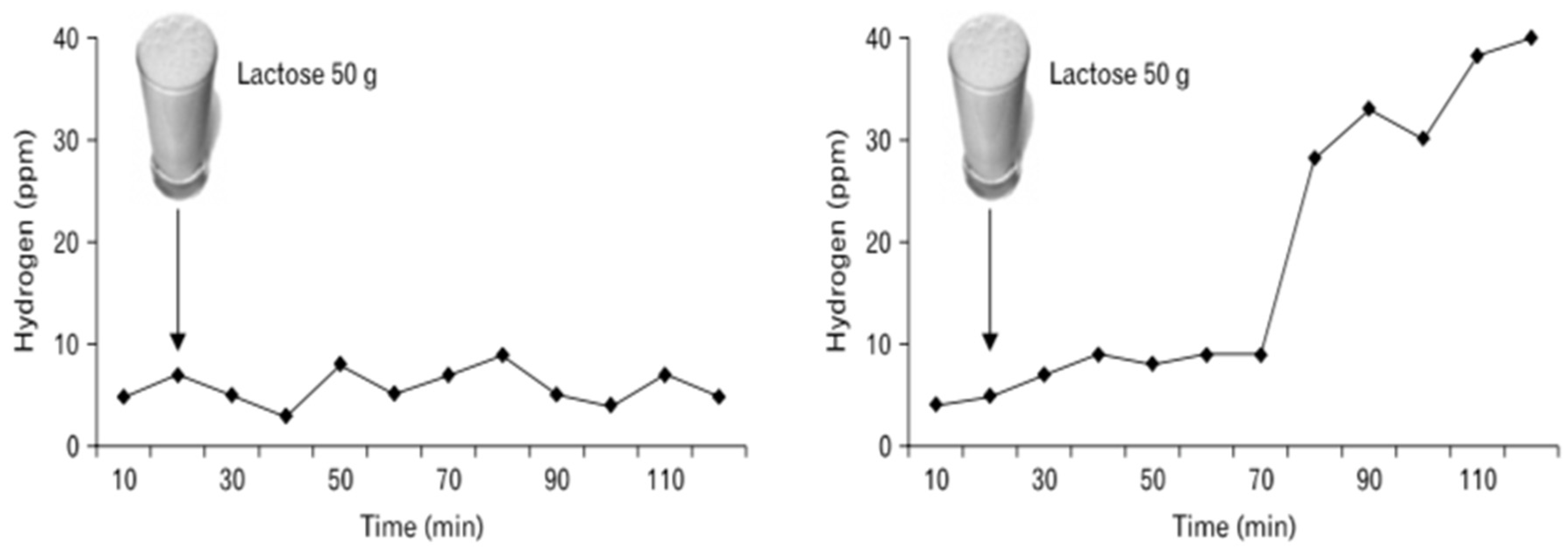 Diagnostics Free FullText Lactose Intolerance What Your Breath