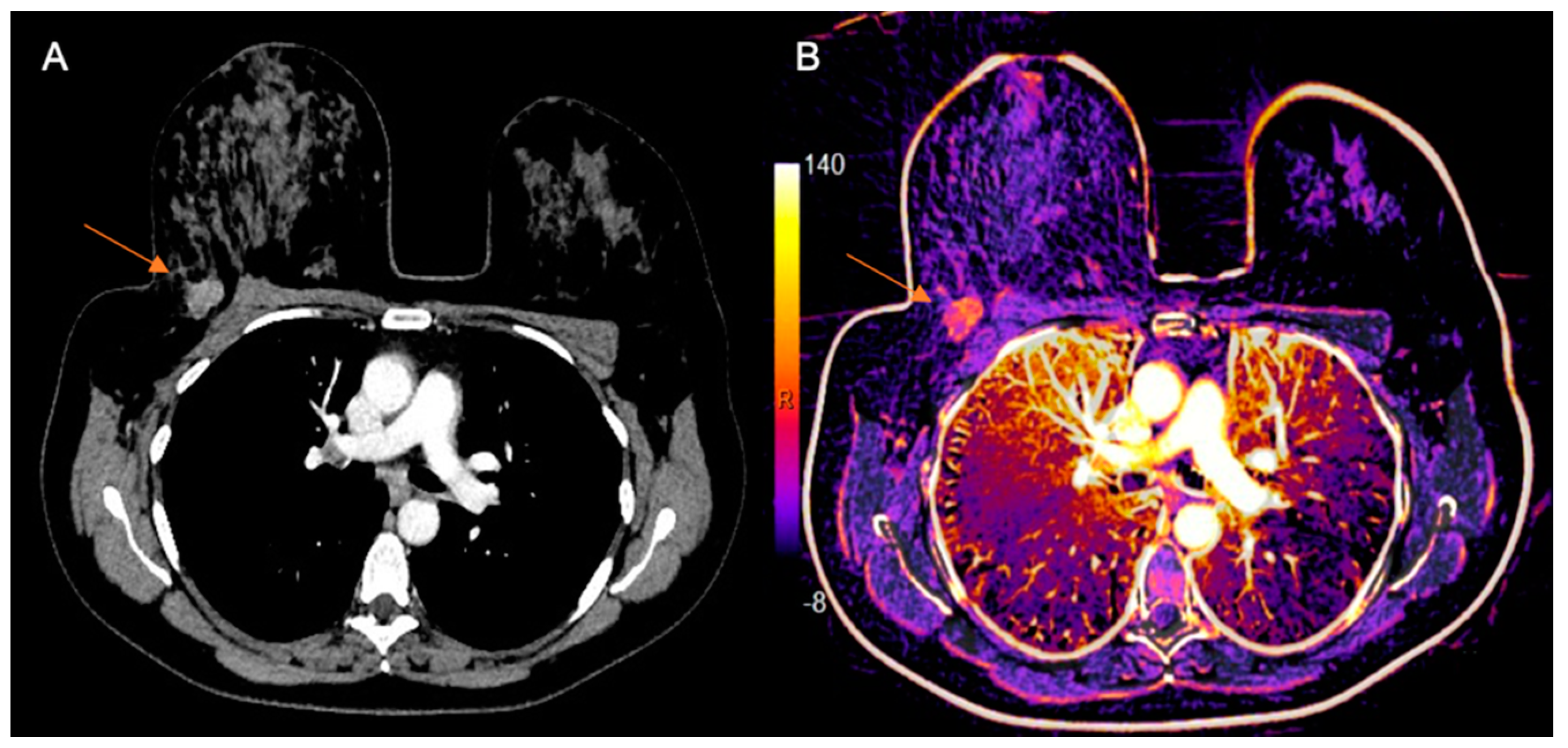 Diagnostics 10 00479 g002 Diagnostics 10 00479 g002