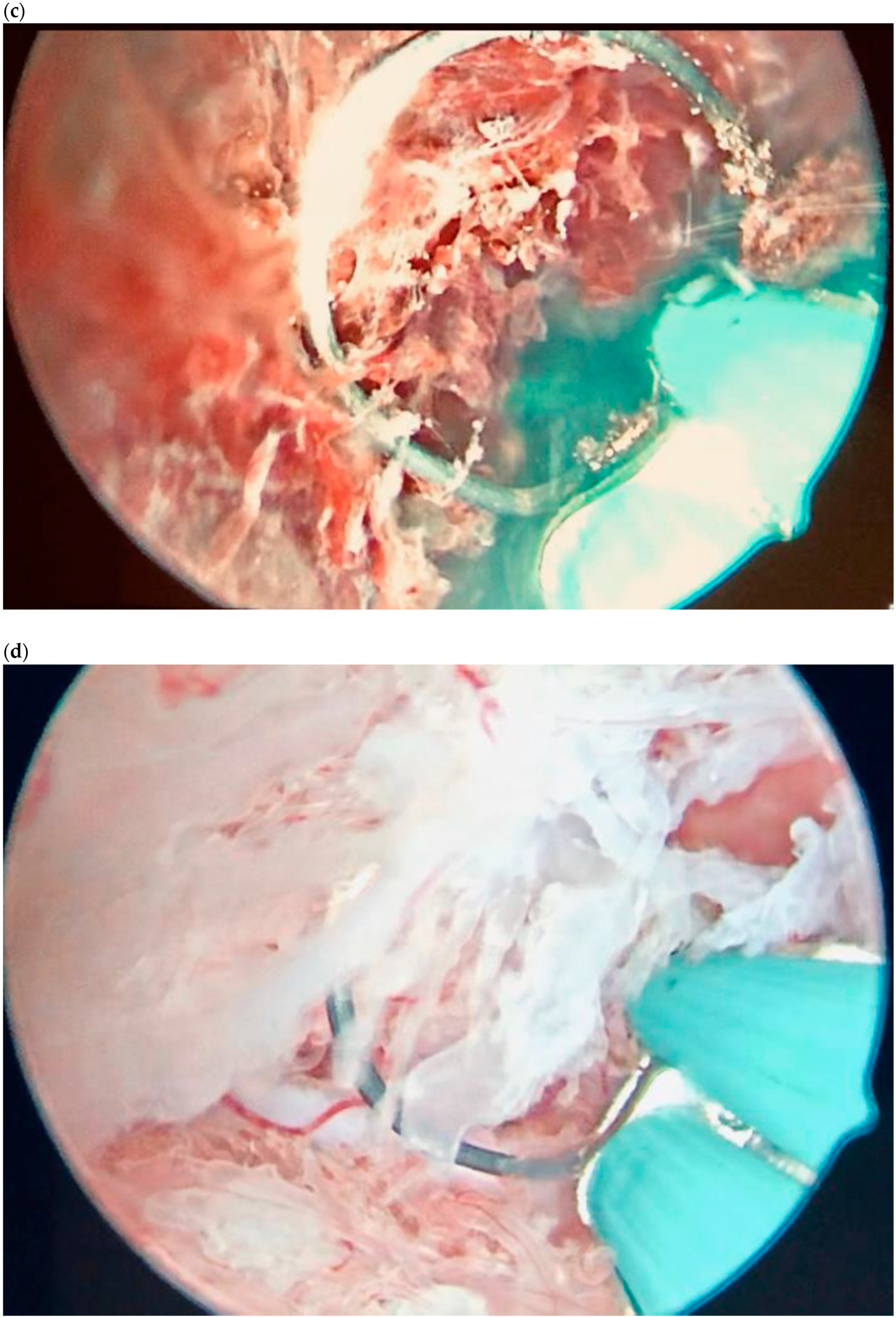 Diagnostics 10 00652 g006b Diagnostics 10 00652 g006b