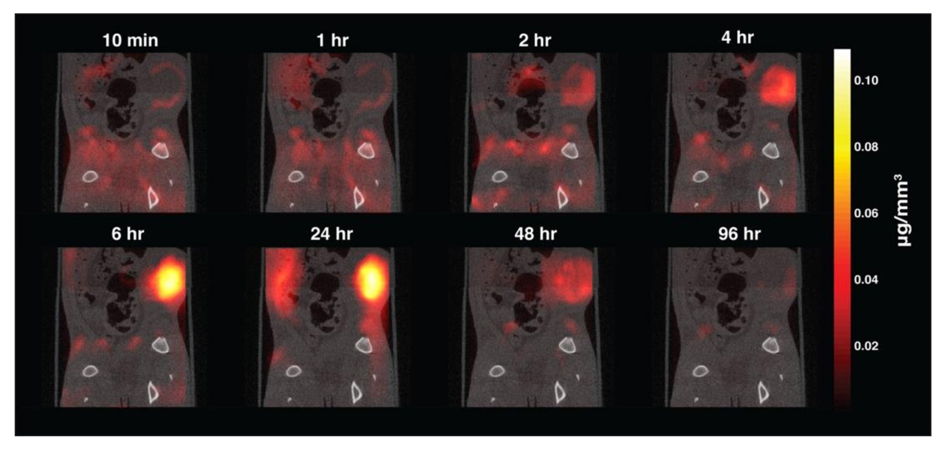 Diagnostics | Free Full-Text | The Applications of Magnetic Particle Imaging:  From Cell to Body | HTML