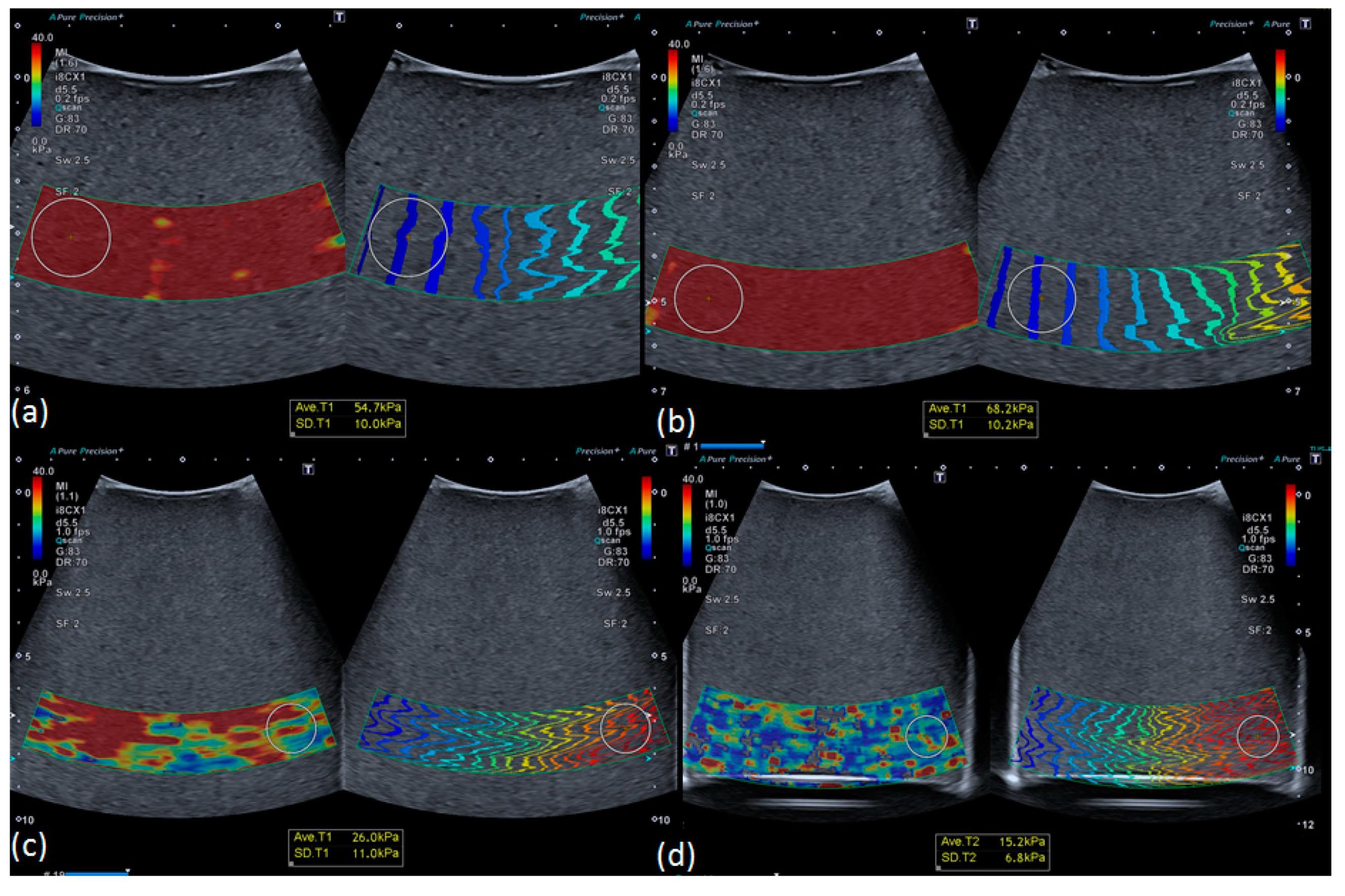 Diagnostics 10 00811 g007 Diagnostics 10 00811 g007