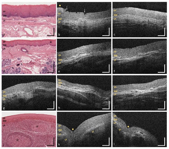 Diagnostics | Free Full-Text | In Vivo Endoscopic Optical Coherence ...