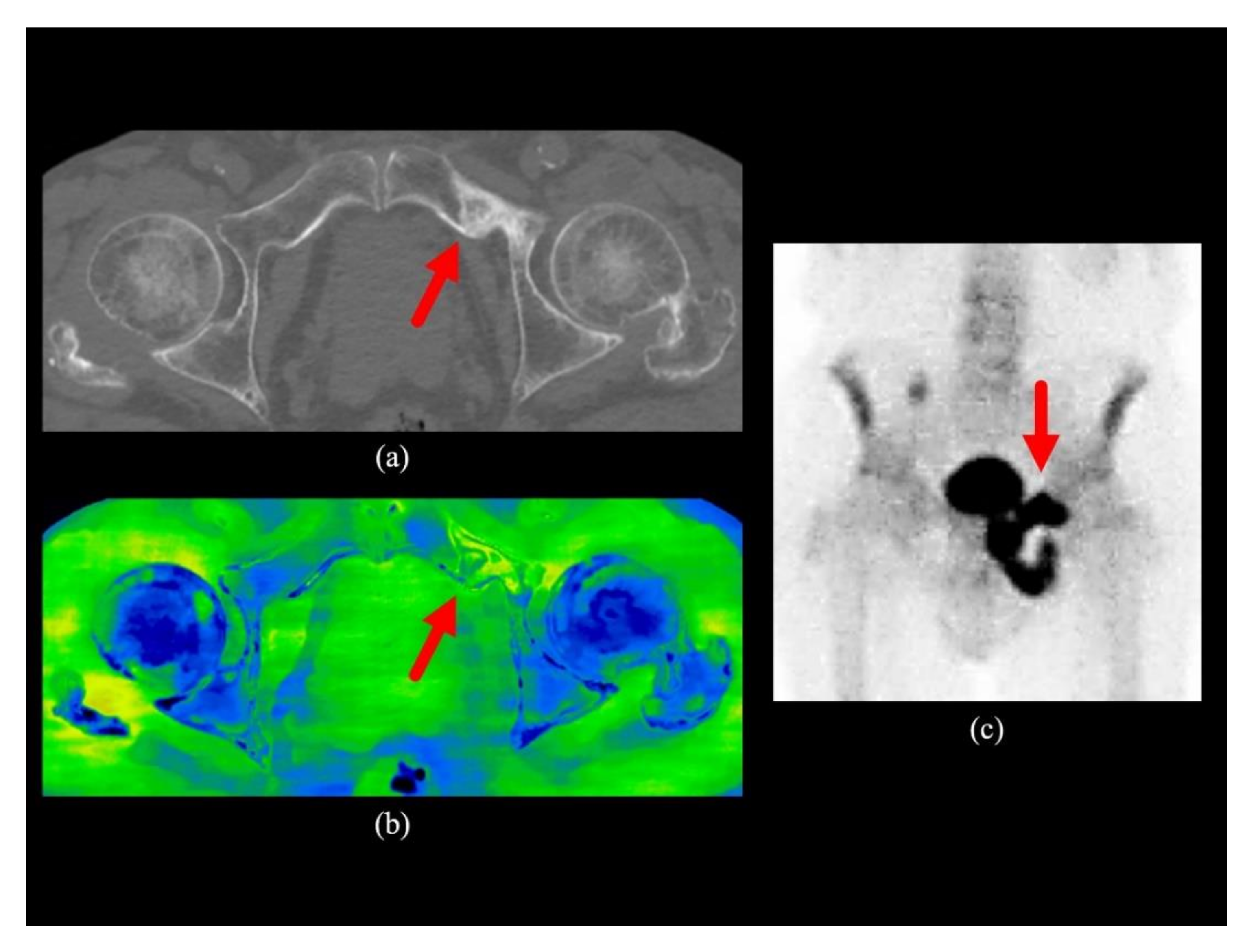 Diagnostics 10 00853 g002 Diagnostics 10 00853 g002