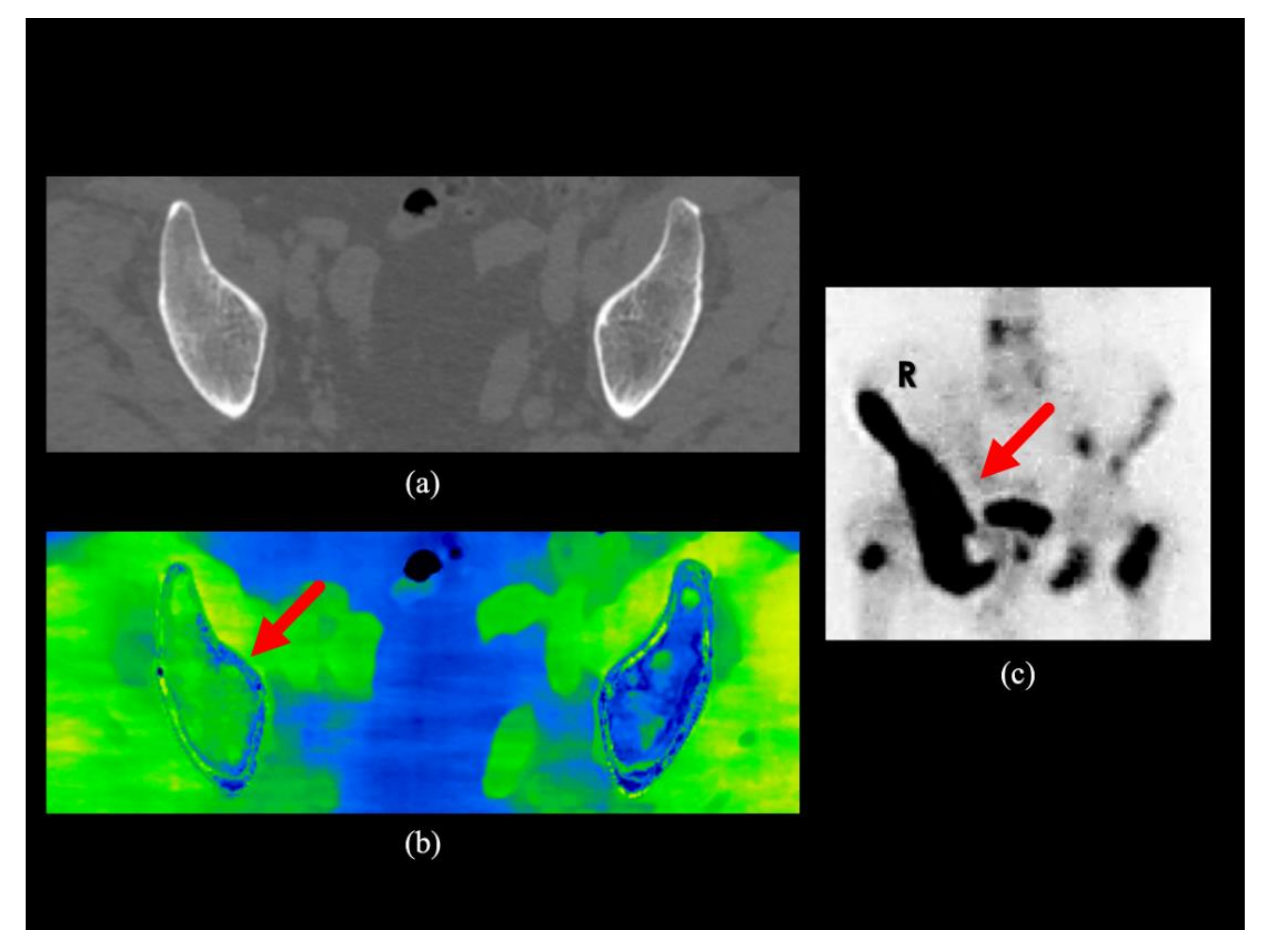 Diagnostics 10 00853 g003 Diagnostics 10 00853 g003