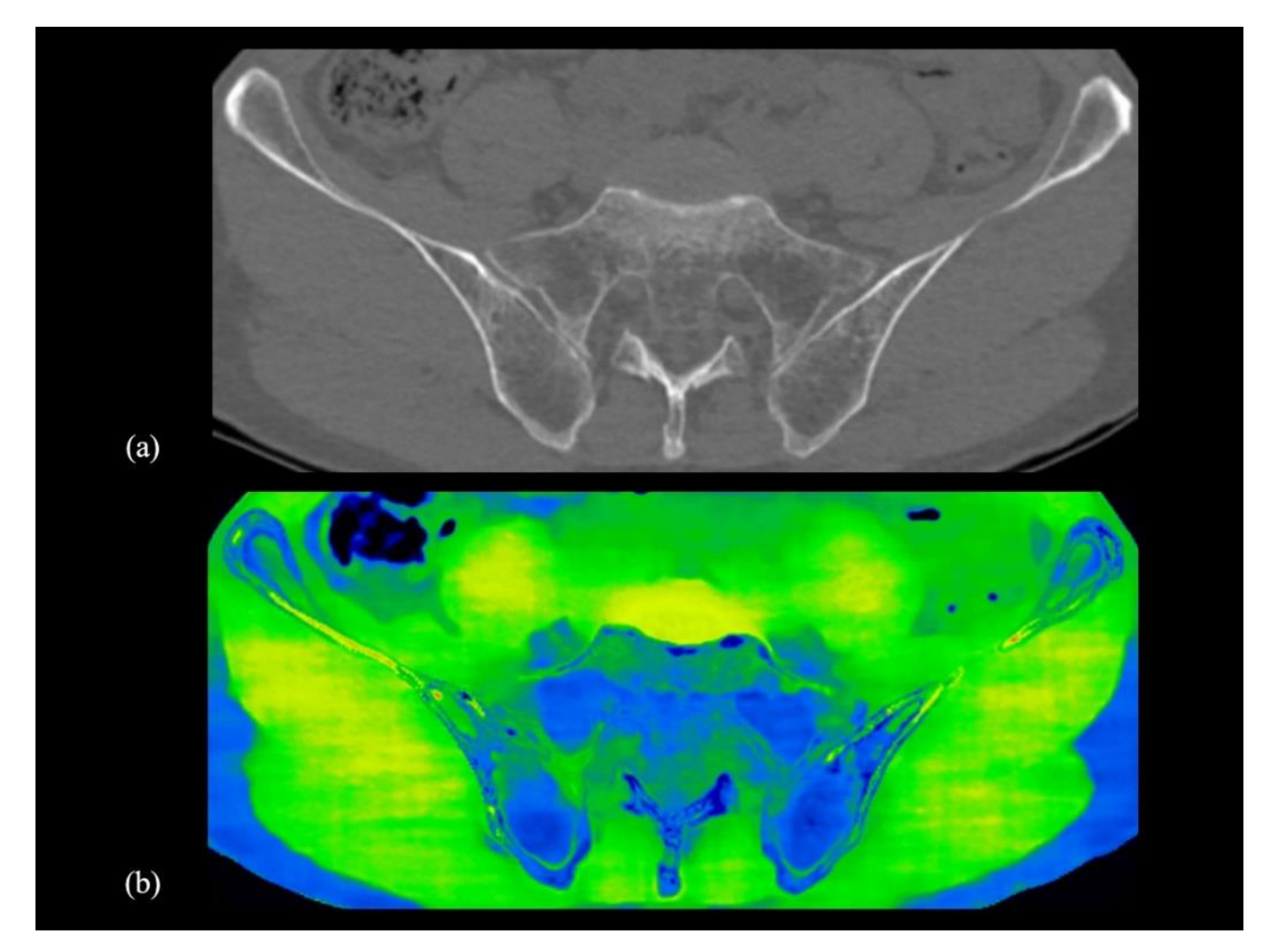 Diagnostics 10 00853 g005 Diagnostics 10 00853 g005