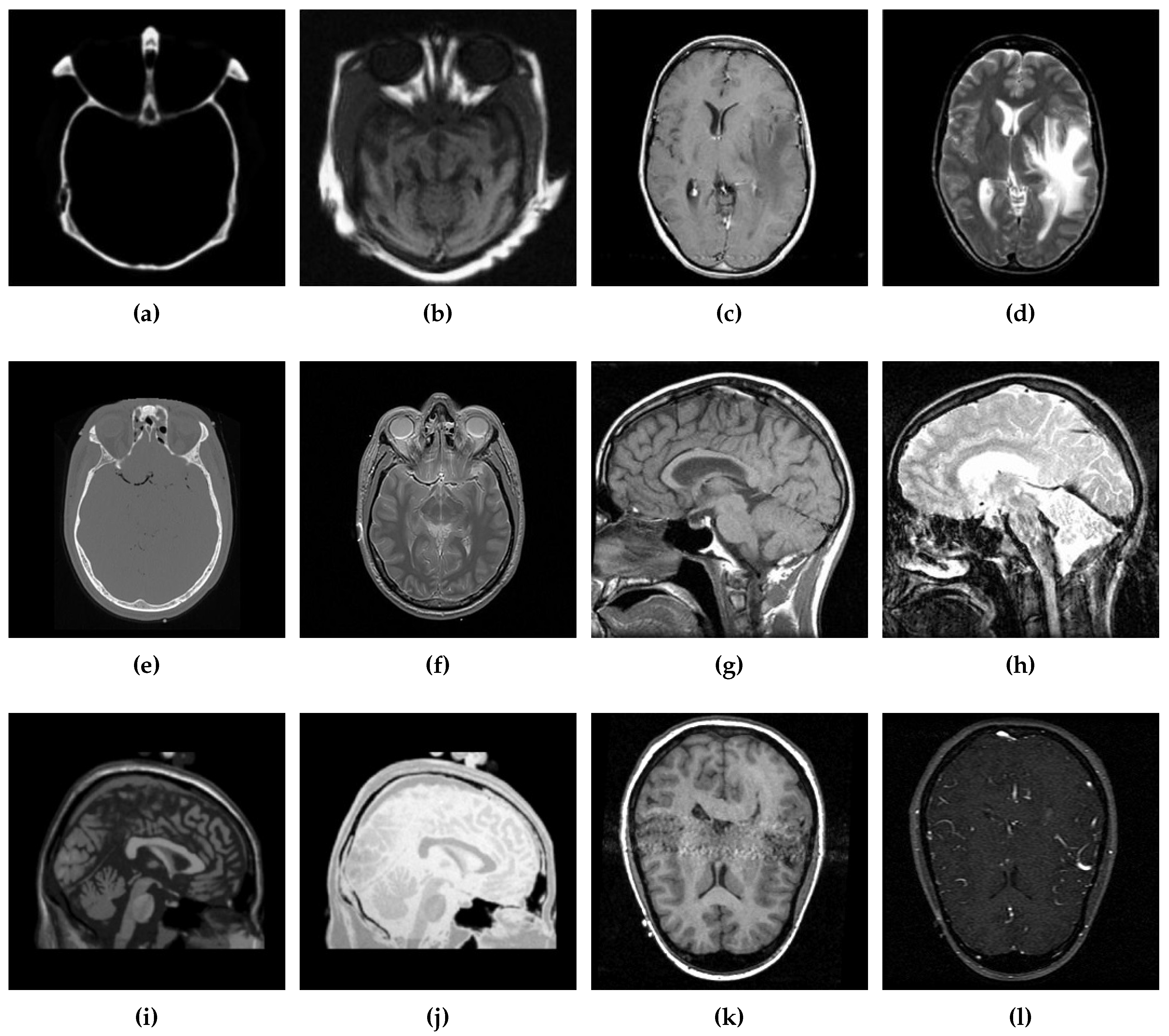 Diagnostics 10 00904 g004 Diagnostics 10 00904 g004