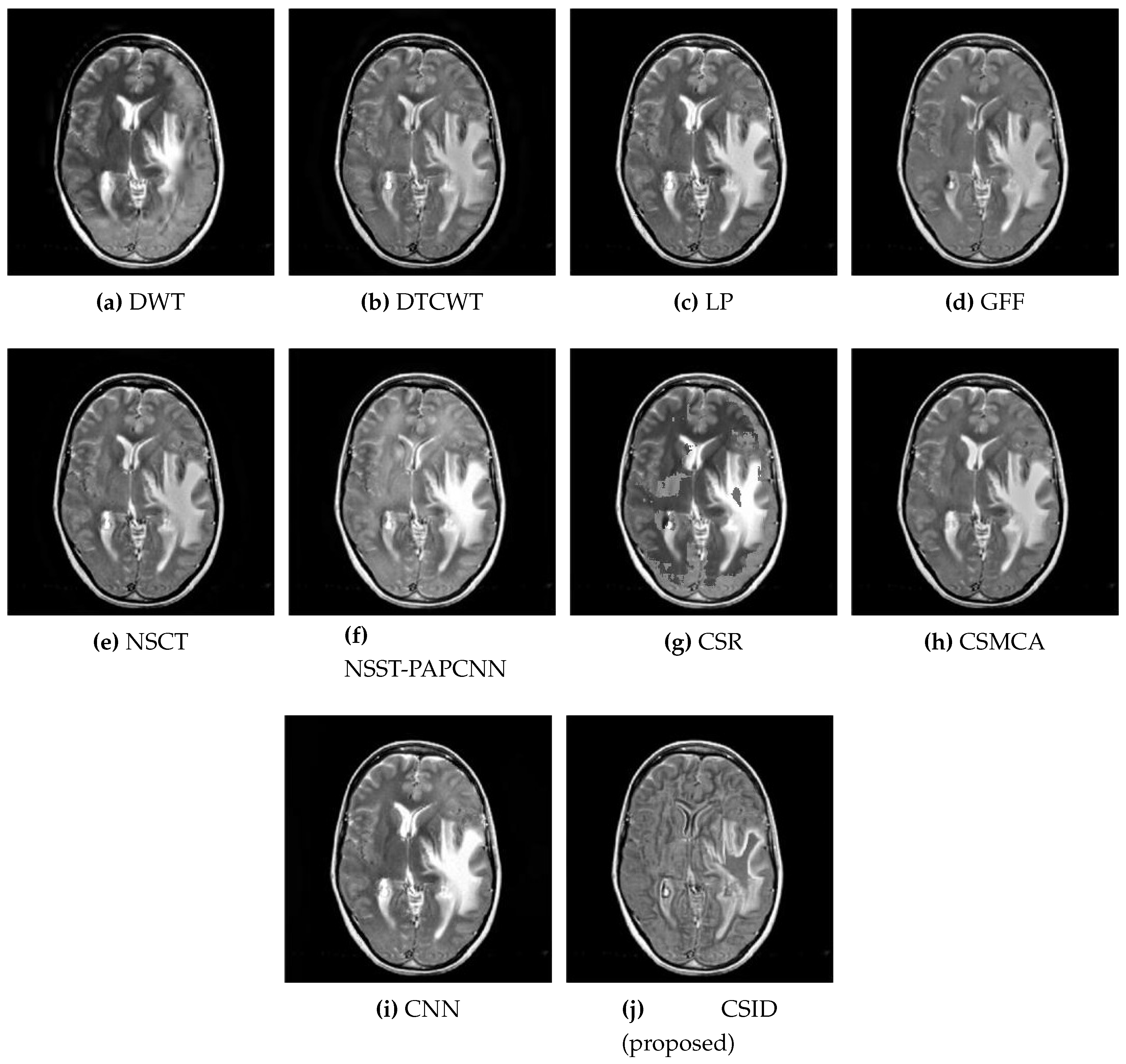 Diagnostics 10 00904 g006 Diagnostics 10 00904 g006
