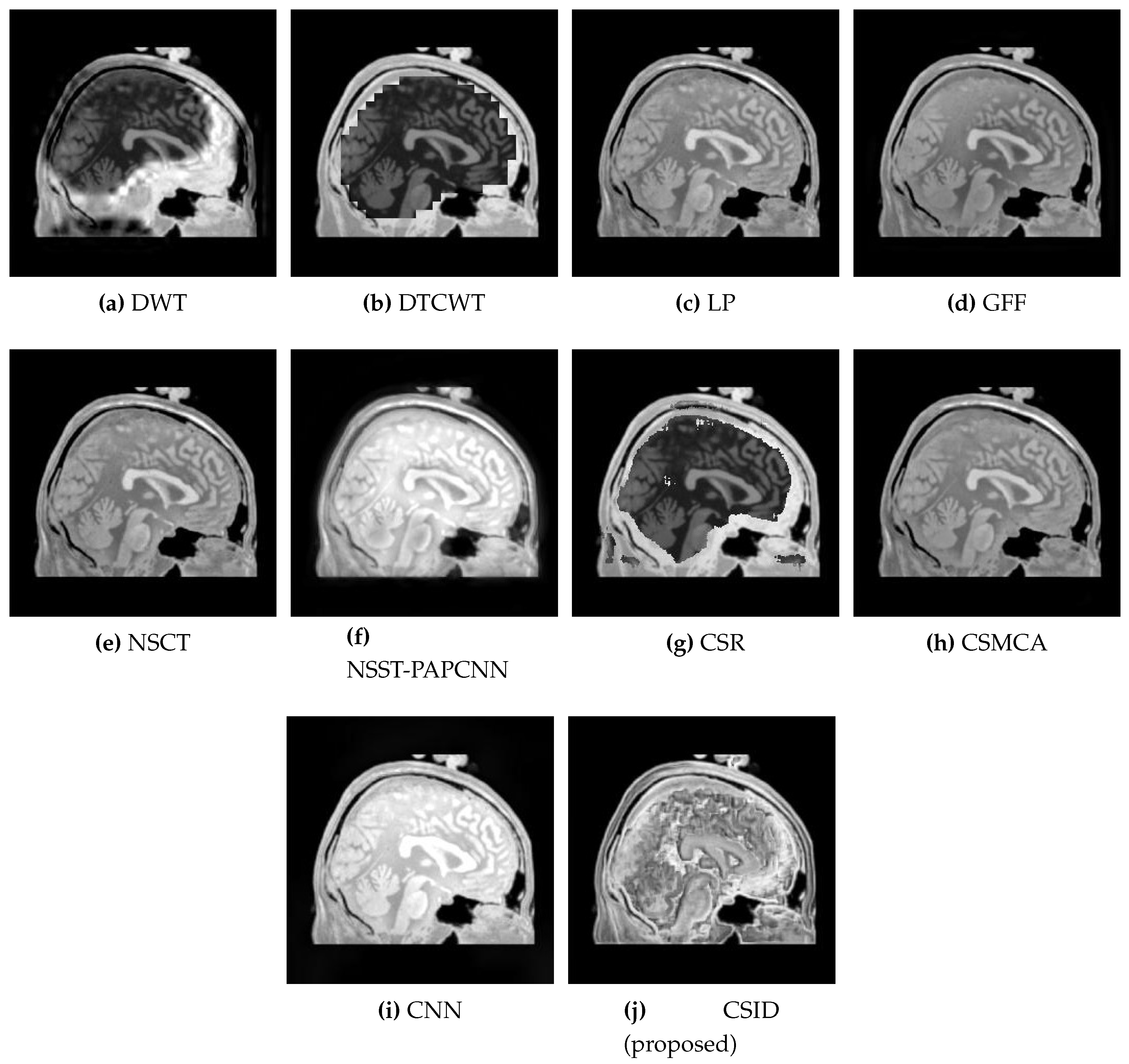 Diagnostics 10 00904 g009 Diagnostics 10 00904 g009
