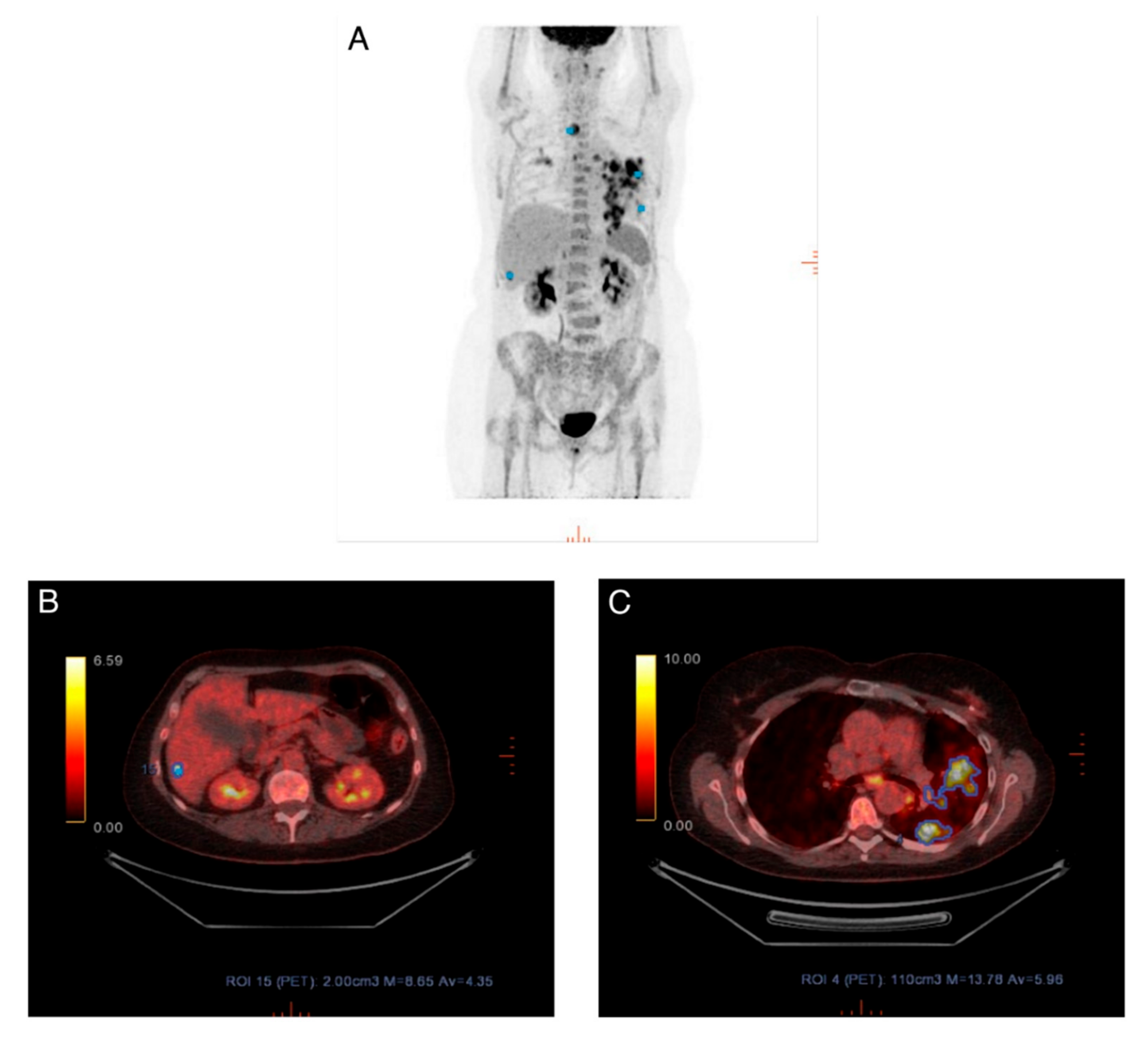 Diagnostics 10 01001 g004 Diagnostics 10 01001 g004