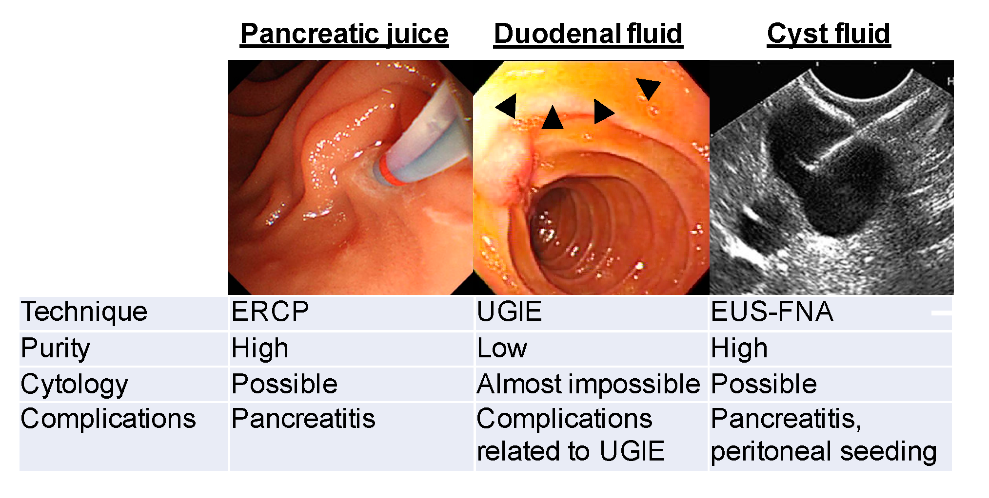 Diagnostics | Free Full-Text | Early Detection of Pancreatic Cancer: Role  of Biomarkers in Pancreatic Fluid Samples