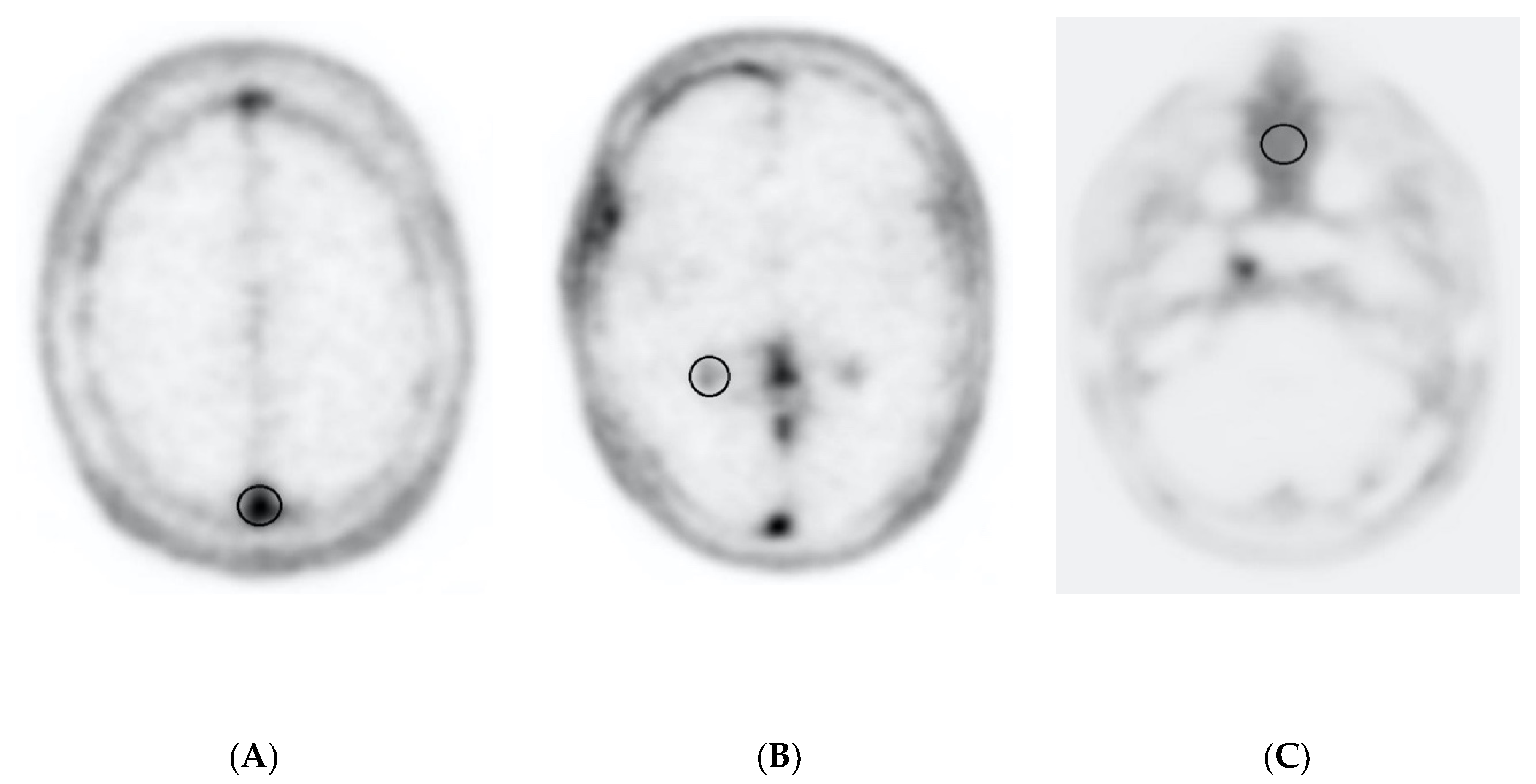 Diagnostics 10 01084 g002 Diagnostics 10 01084 g002