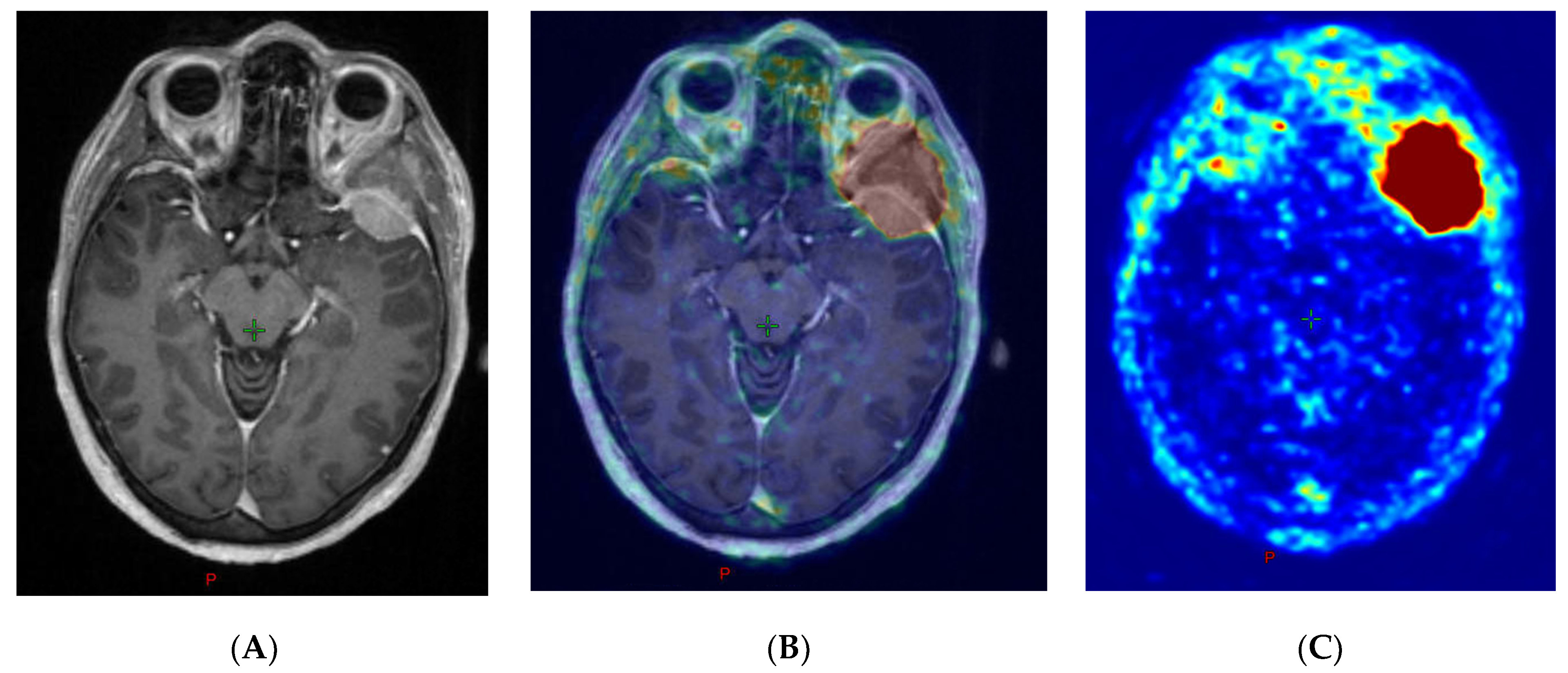 Diagnostics 10 01084 g003 Diagnostics 10 01084 g003