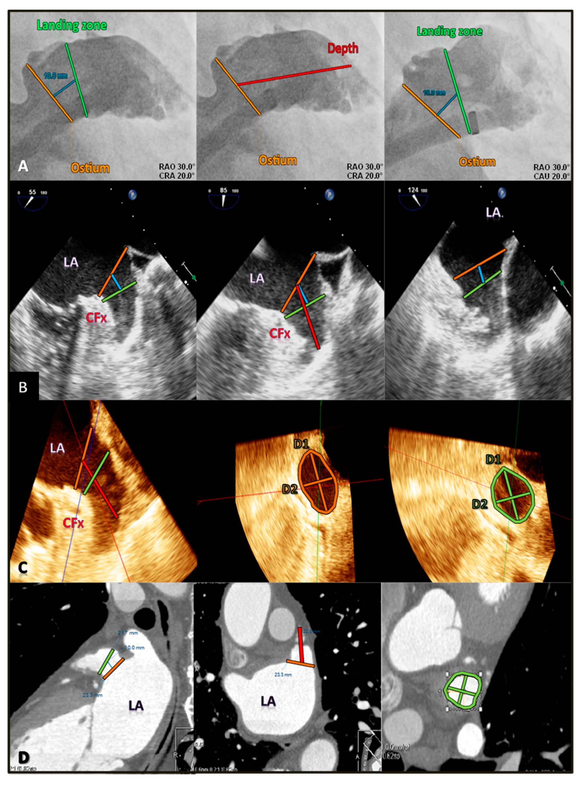 PDF) Novelties in 3D Transthoracic Echocardiography