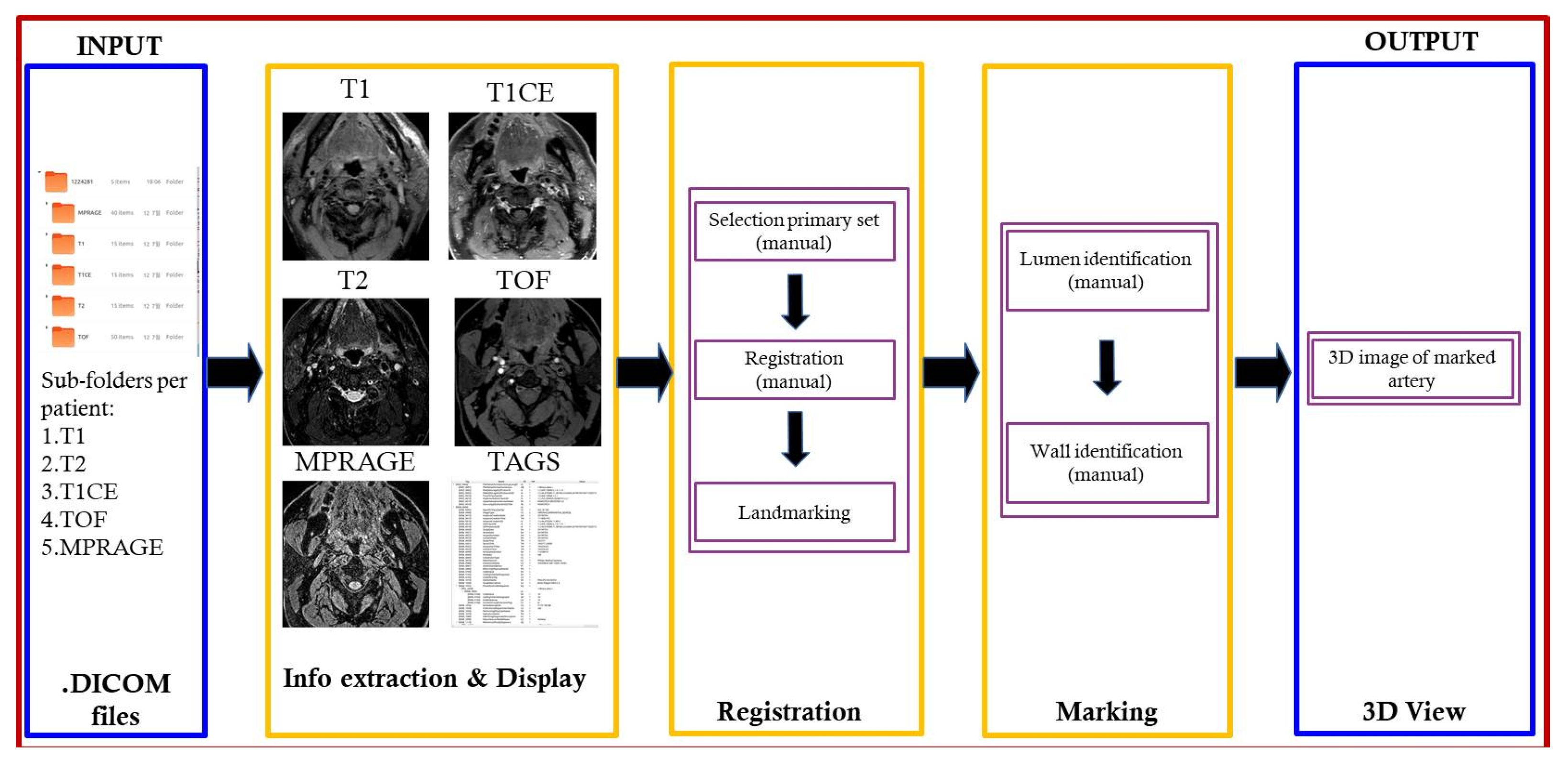 Diagnostics | Free Full-Text | Carotid Artery Plaque Identification and ...