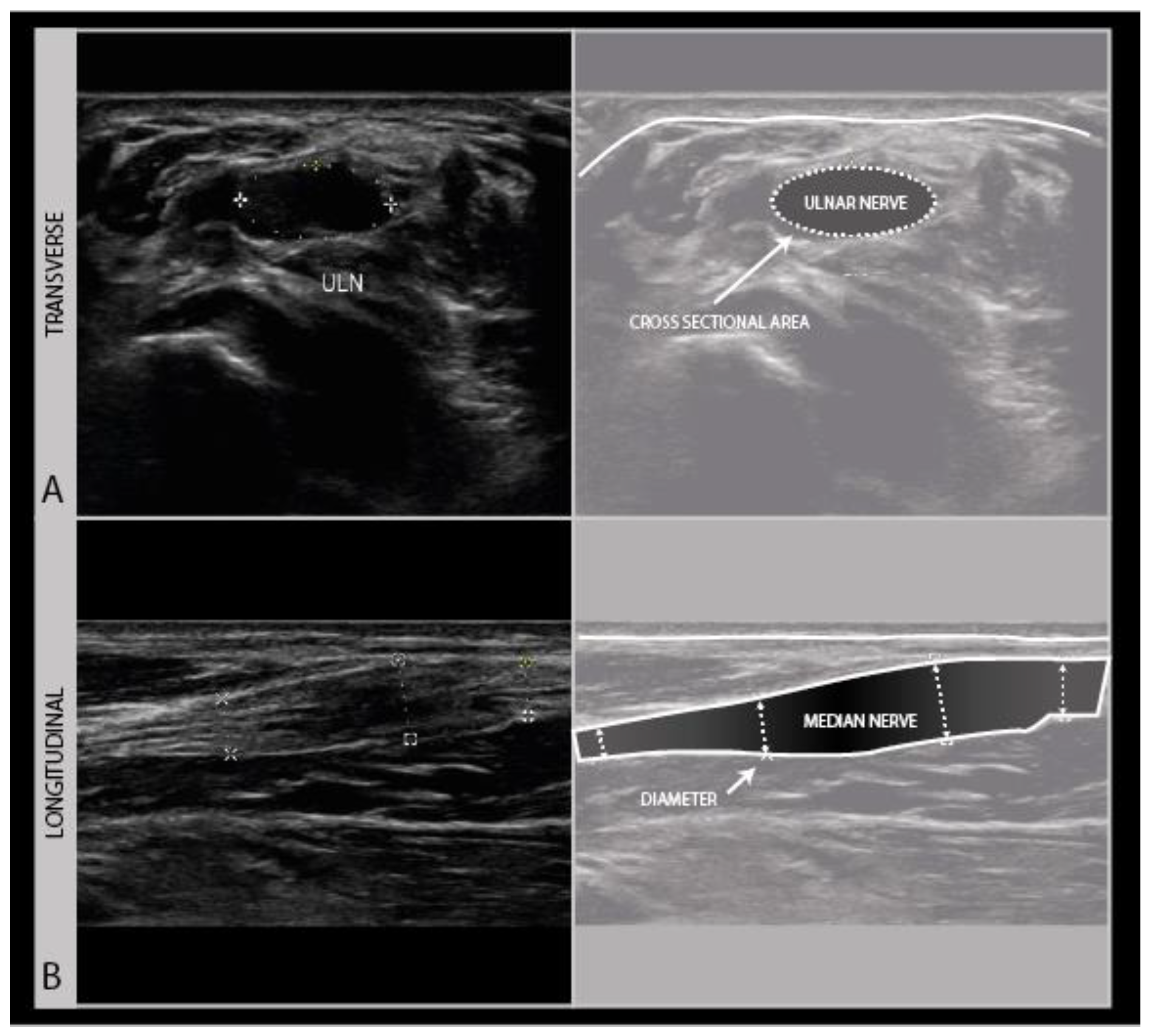 Trauma – RMG Ultrasound