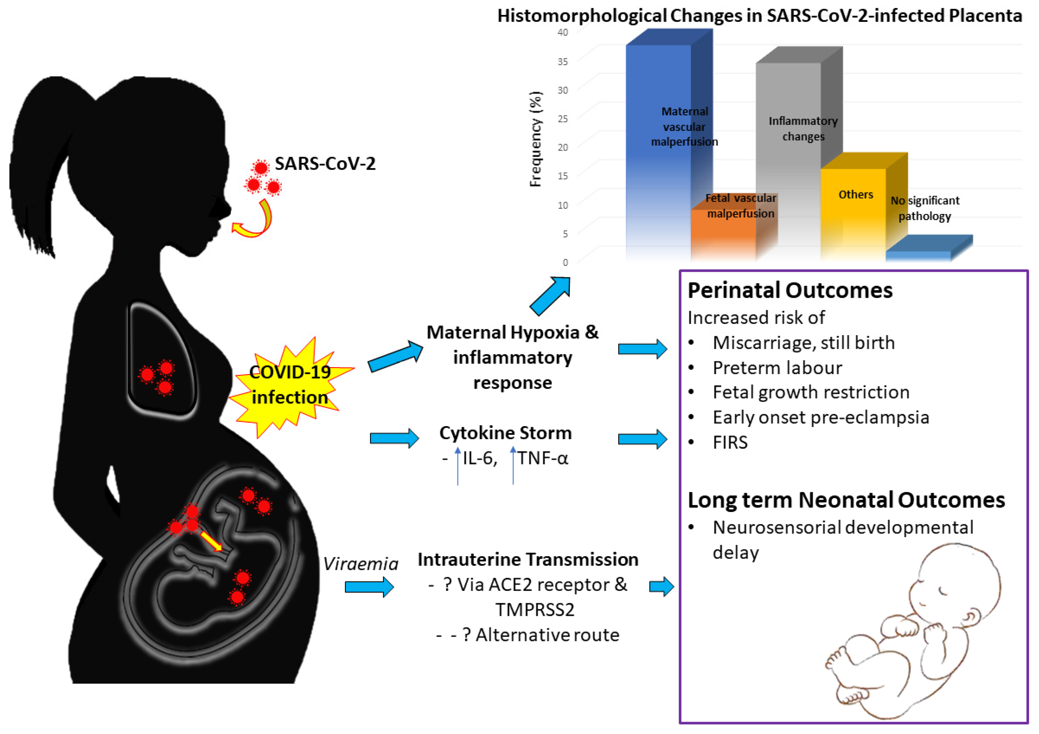 Frontiers  Case Report: SARS-CoV-2 Mother-to-Child Transmission and Fetal  Death Associated With Severe Placental Thromboembolism