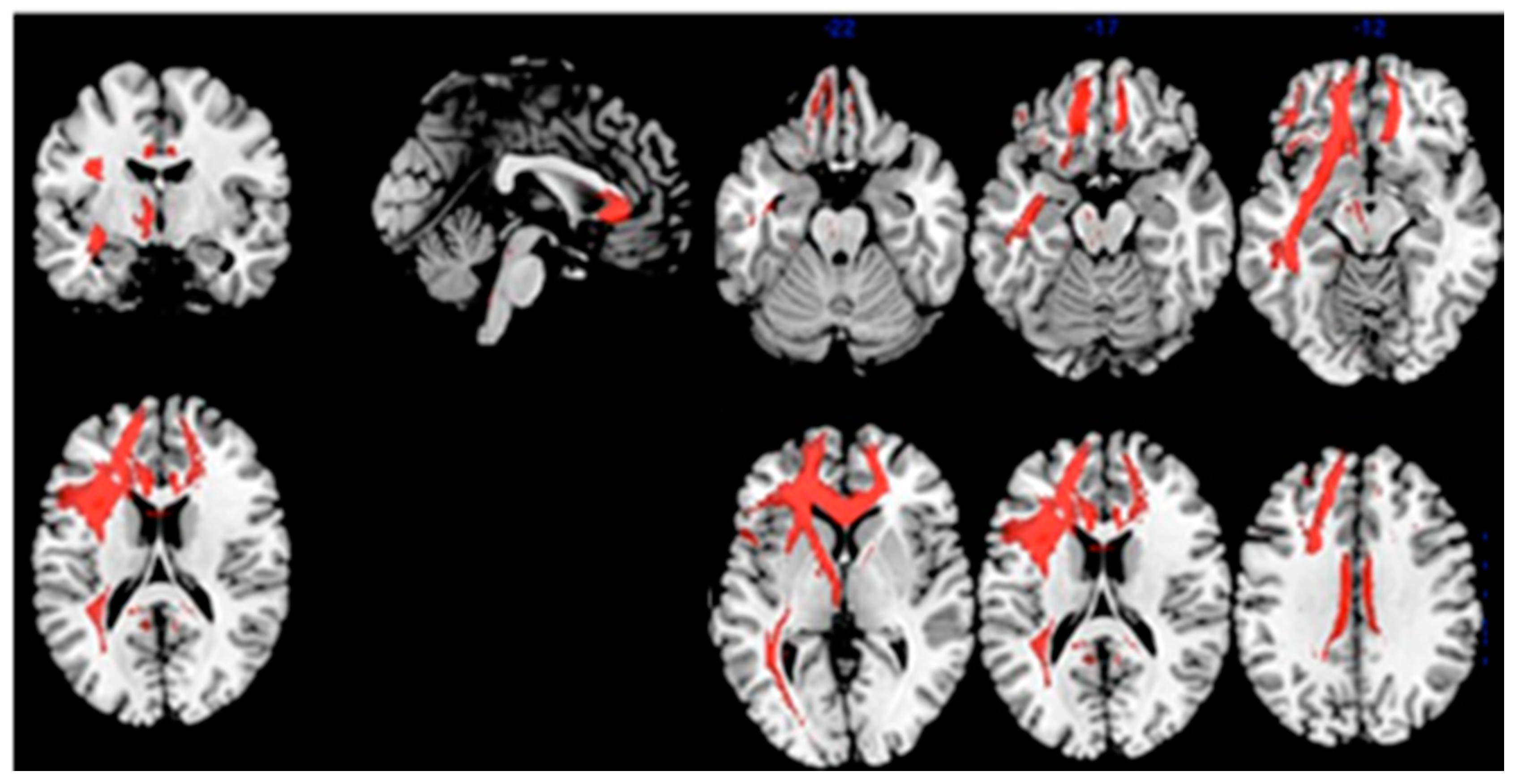 Diagnostics 11 00108 g004 Diagnostics 11 00108 g004