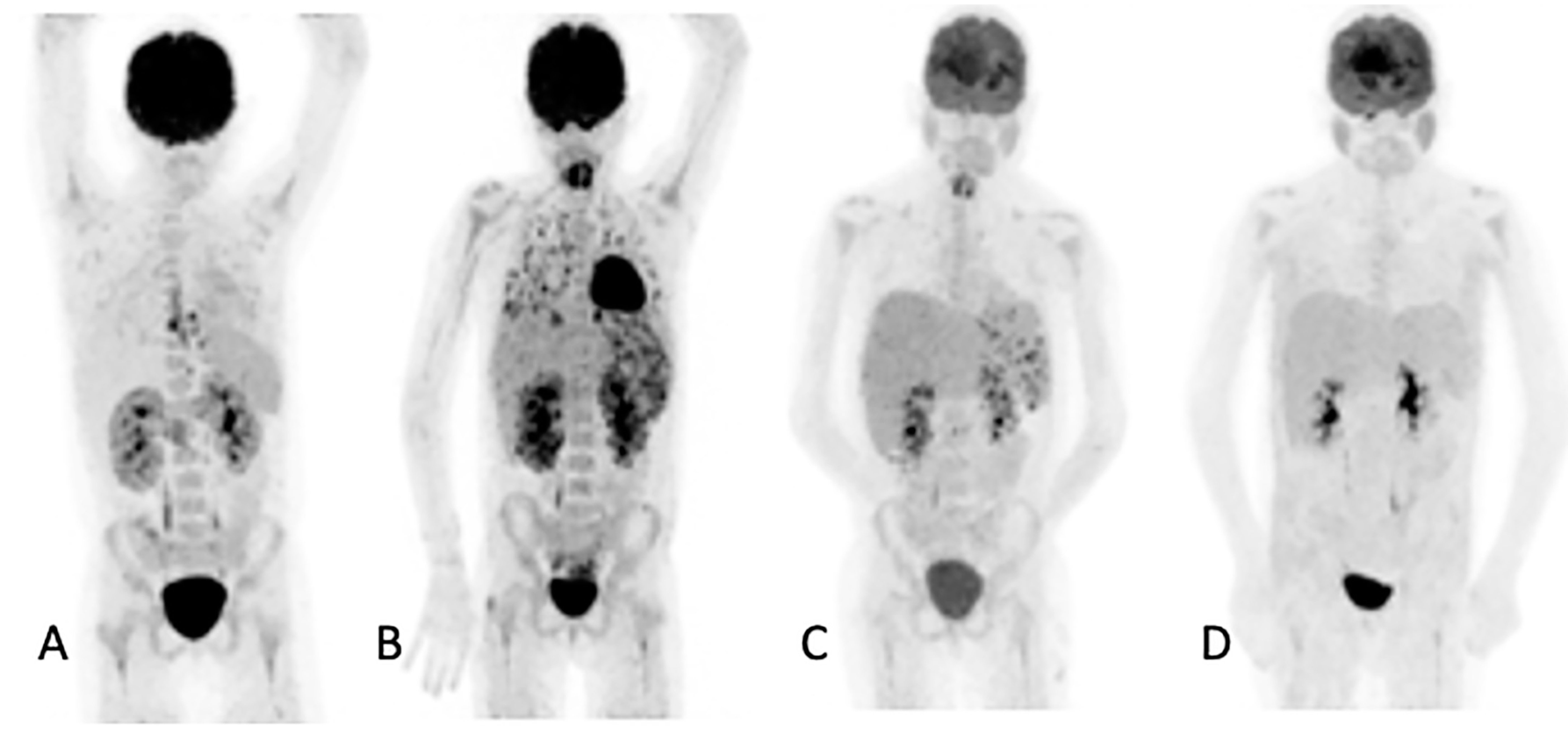 Diagnostics 11 00137 g003 Diagnostics 11 00137 g003