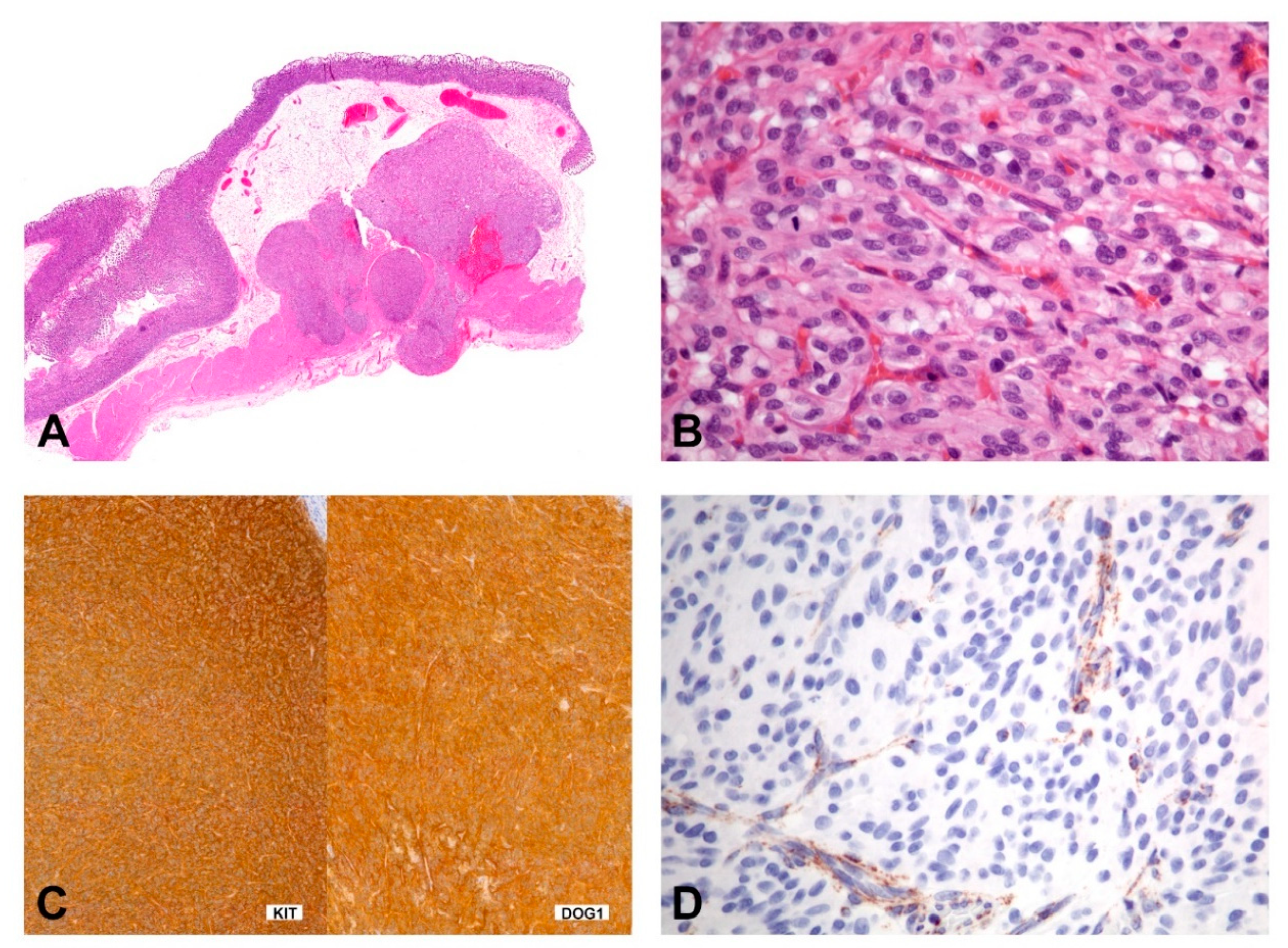 Diagnostics 11 00194 g008 Diagnostics 11 00194 g008