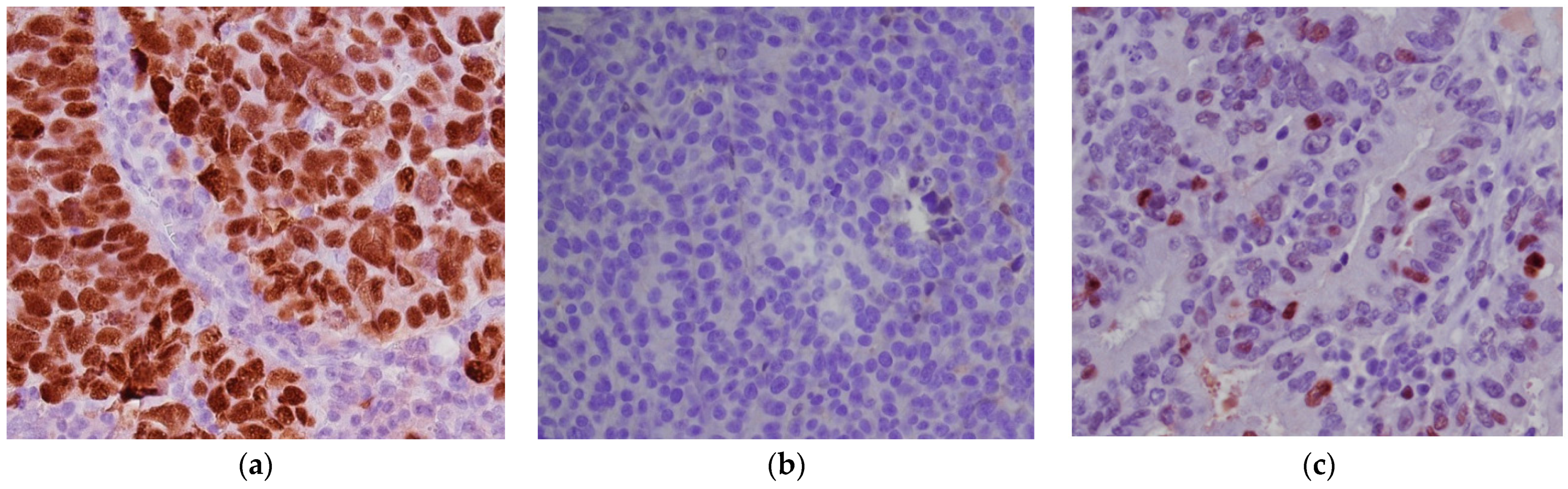 Diagnostics 11 00199 g002