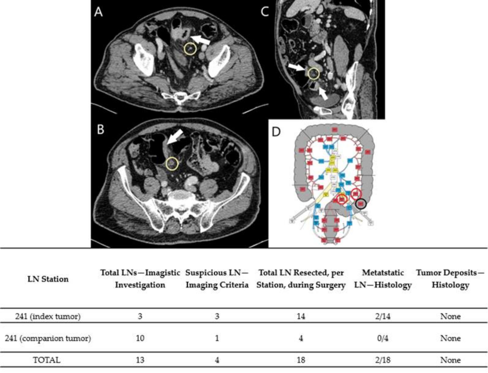 Diagnostics Free Full Text Synchronous Colorectal Cancer Improving Accuracy Of Detection