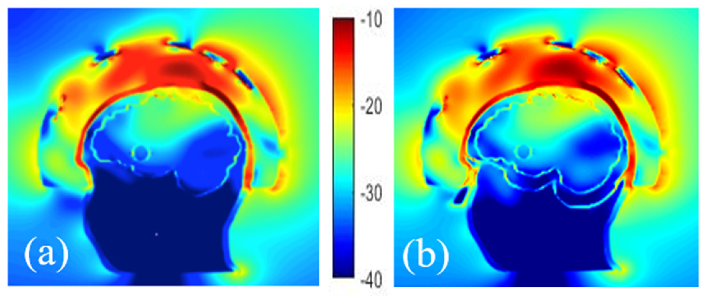 Diagnostics 11 00376 g008 Diagnostics 11 00376 g008